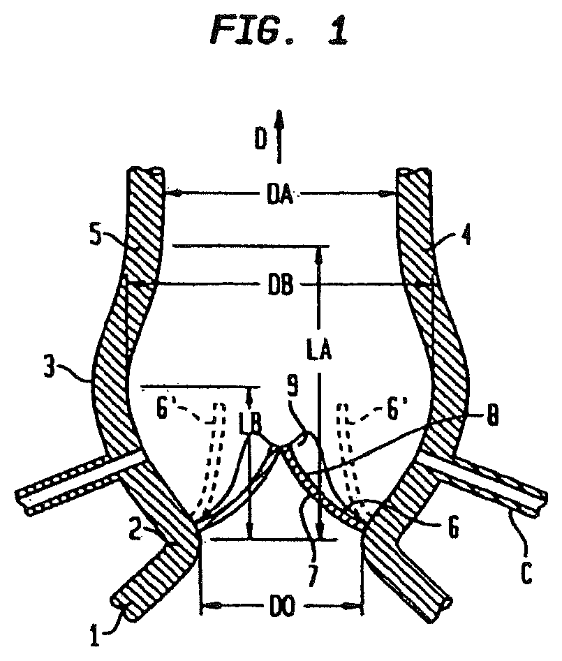 Patent US12090047 Figure 1 – Collapsible and re-expandable prosthetic heart valve cuff designs and complementary technological applications