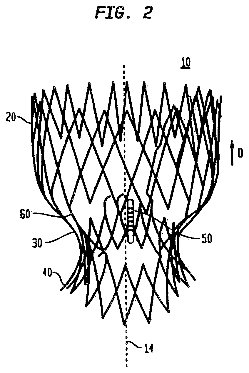 Patent US12090047 Figure 2 – Collapsible and re-expandable prosthetic heart valve cuff designs and complementary technological applications