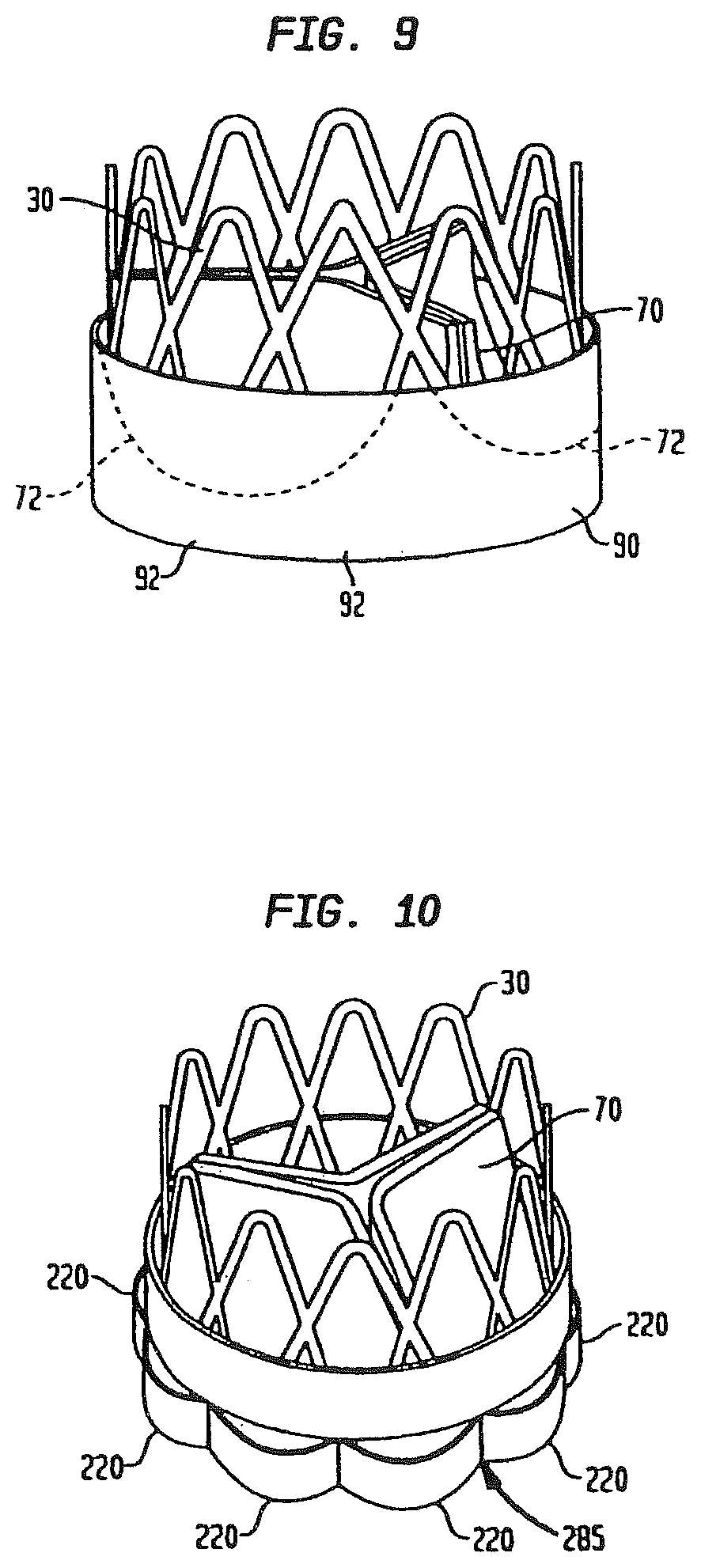 Patent US12090047 Figure 6 – Collapsible and re-expandable prosthetic heart valve cuff designs and complementary technological applications