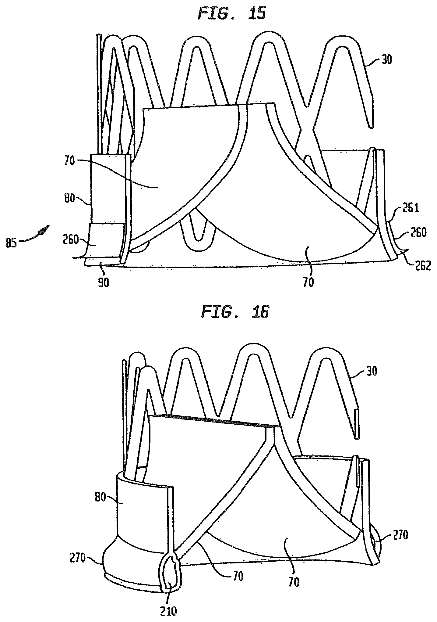 Patent US12090047 Figure 10 – Collapsible and re-expandable prosthetic heart valve cuff designs and complementary technological applications