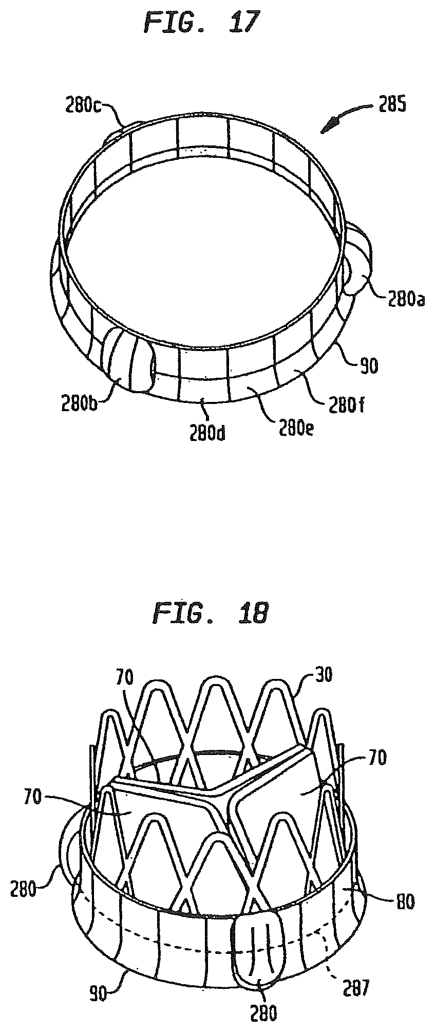 Patent US12090047 Figure 11 – Collapsible and re-expandable prosthetic heart valve cuff designs and complementary technological applications