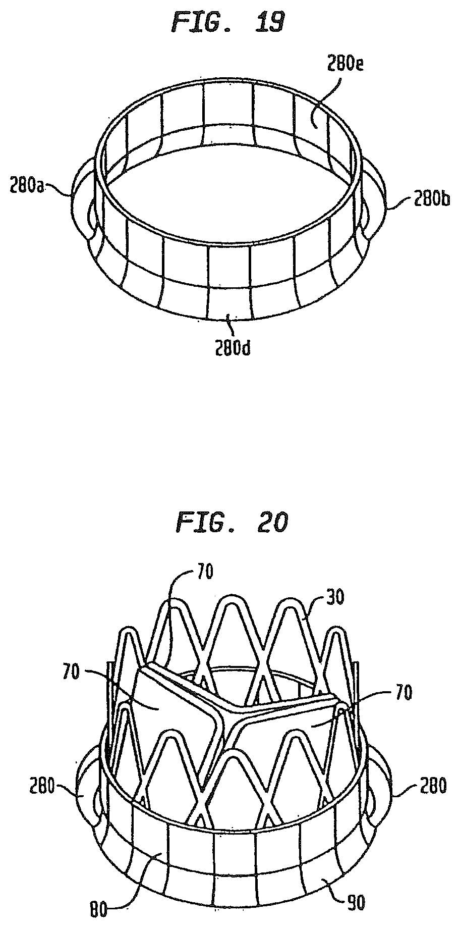 Patent US12090047 Figure 12 – Collapsible and re-expandable prosthetic heart valve cuff designs and complementary technological applications