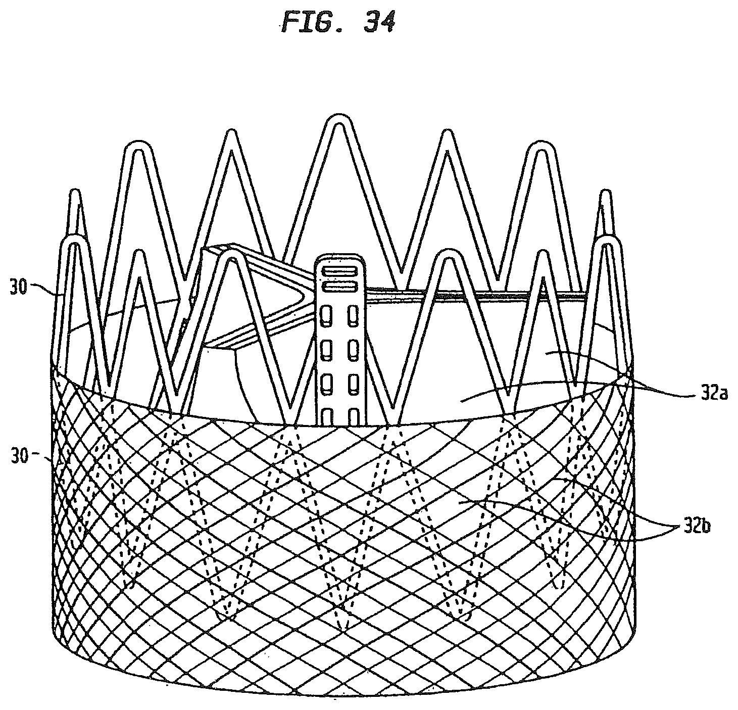 Patent US12090047 Figure 17 – Collapsible and re-expandable prosthetic heart valve cuff designs and complementary technological applications
