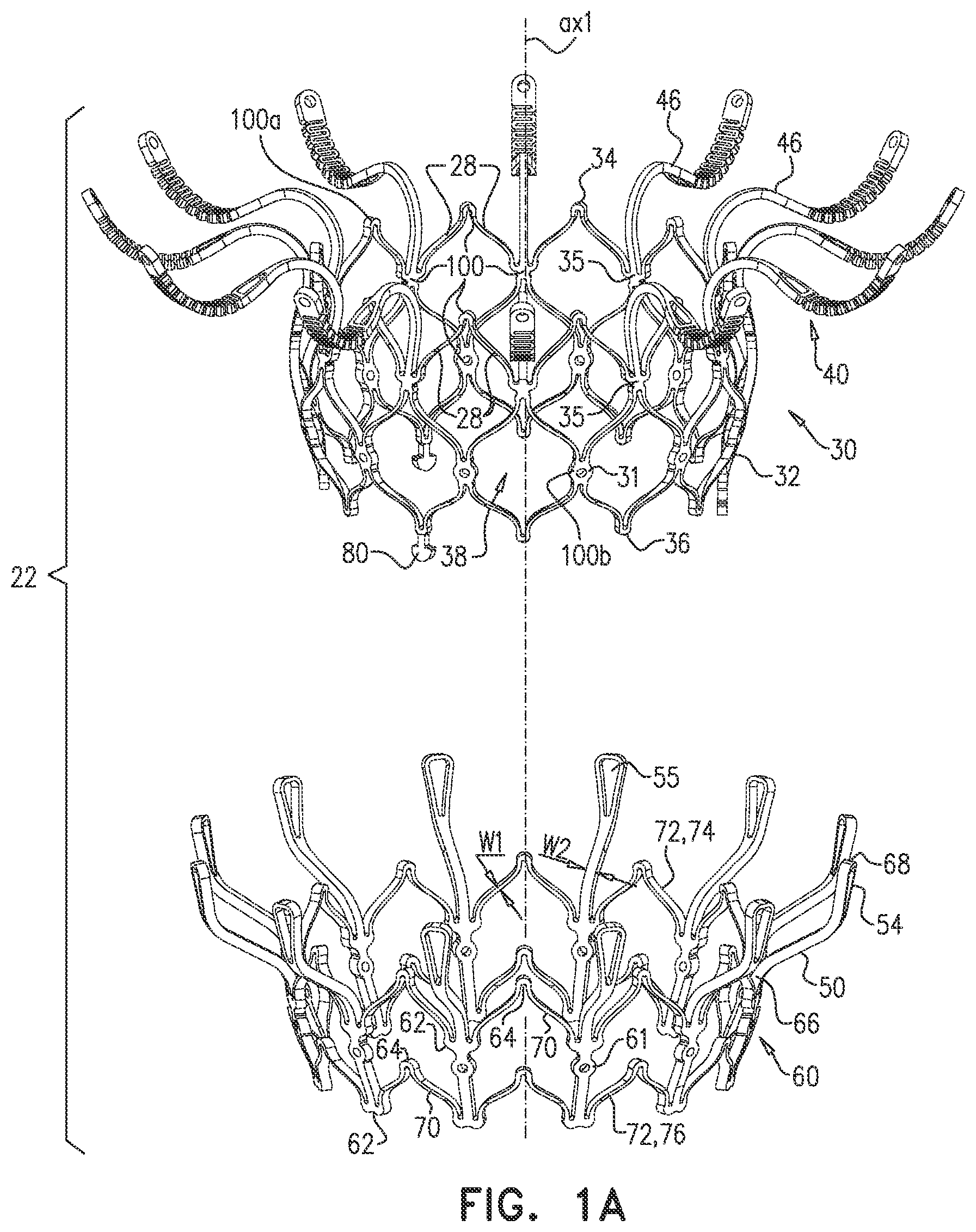 Patent US12090048 Figure 1 – Prosthetic heart valve