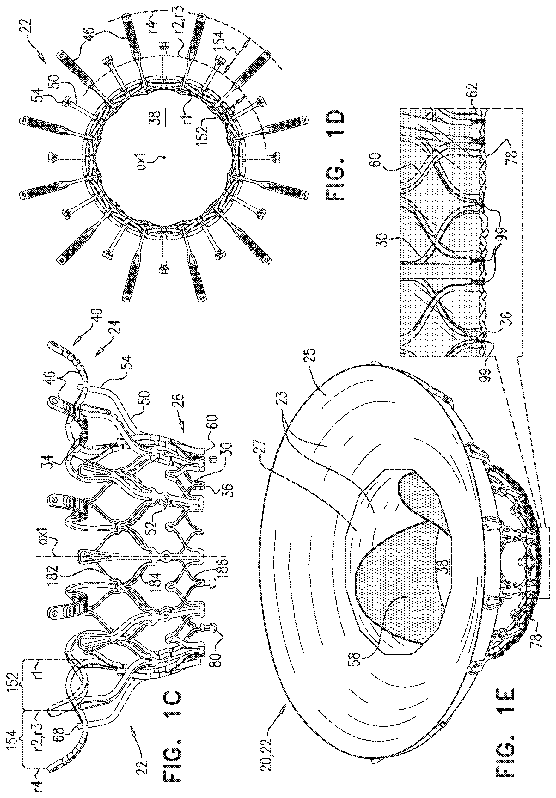 Patent US12090048 Figure 3 – Prosthetic heart valve