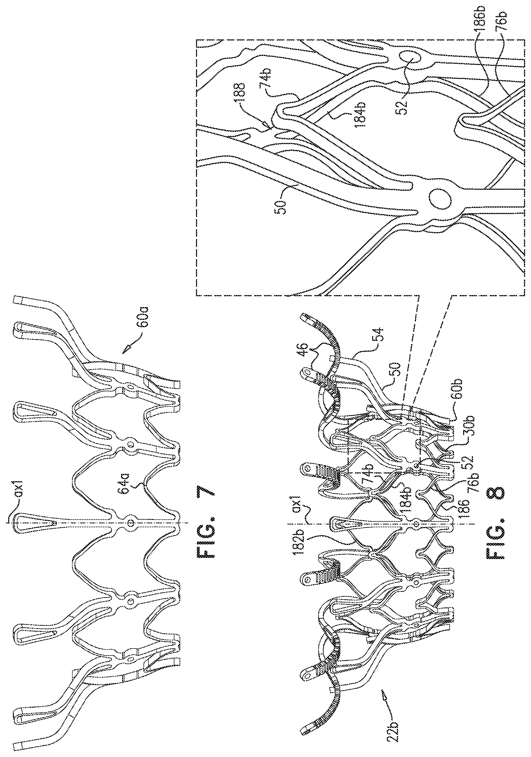 Patent US12090048 Figure 11 – Prosthetic heart valve