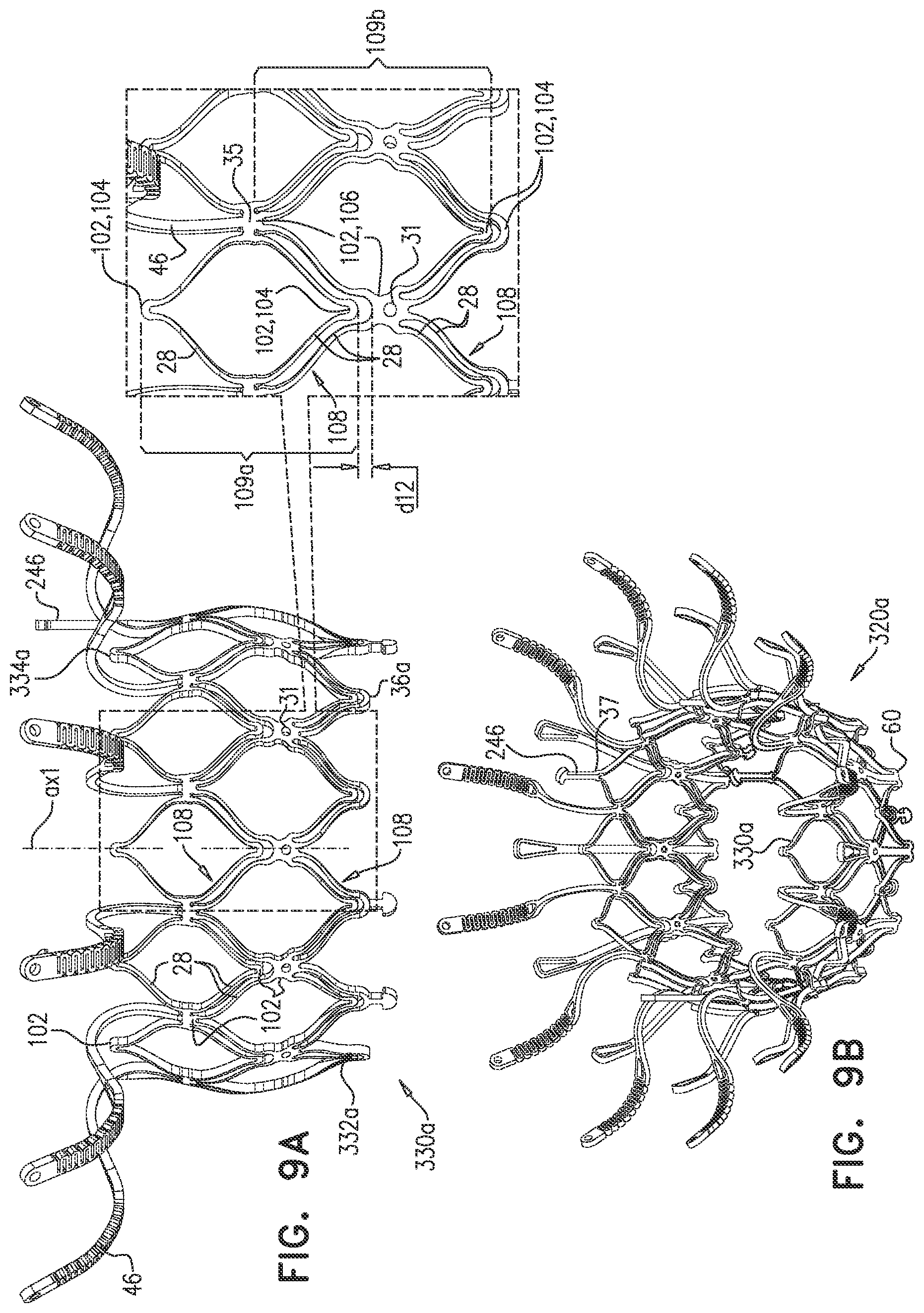 Patent US12090048 Figure 12 – Prosthetic heart valve