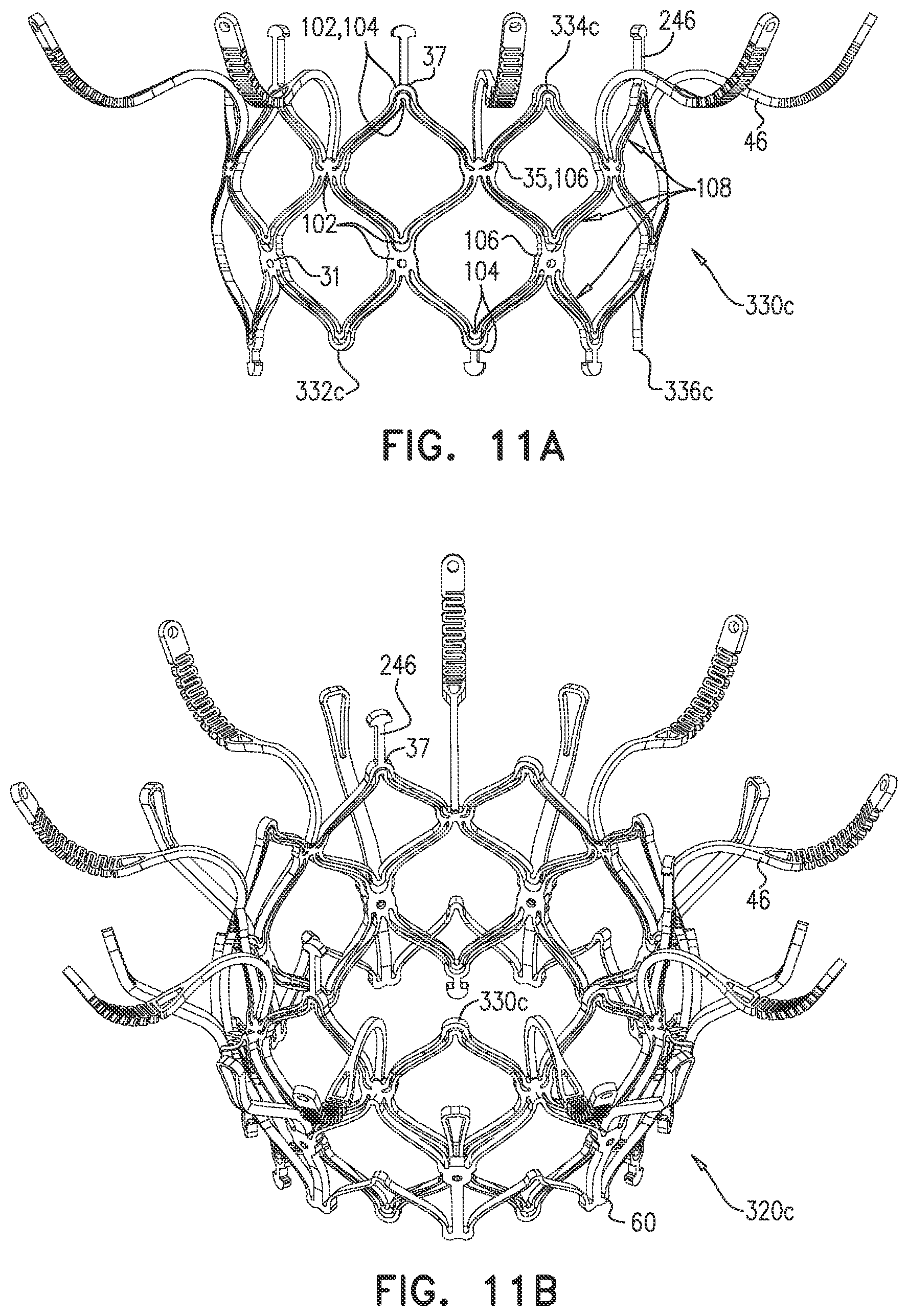 Patent US12090048 Figure 14 – Prosthetic heart valve