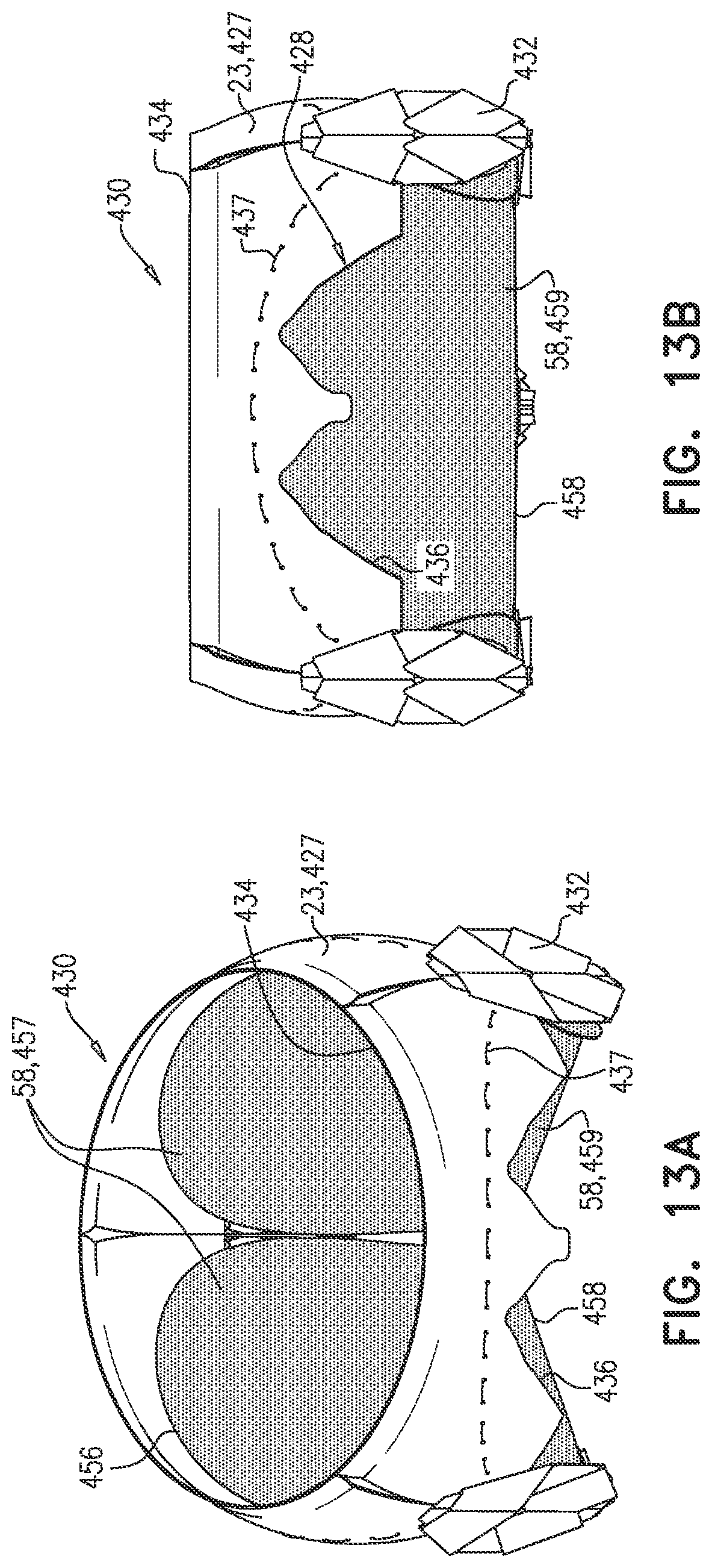 Patent US12090048 Figure 17 – Prosthetic heart valve