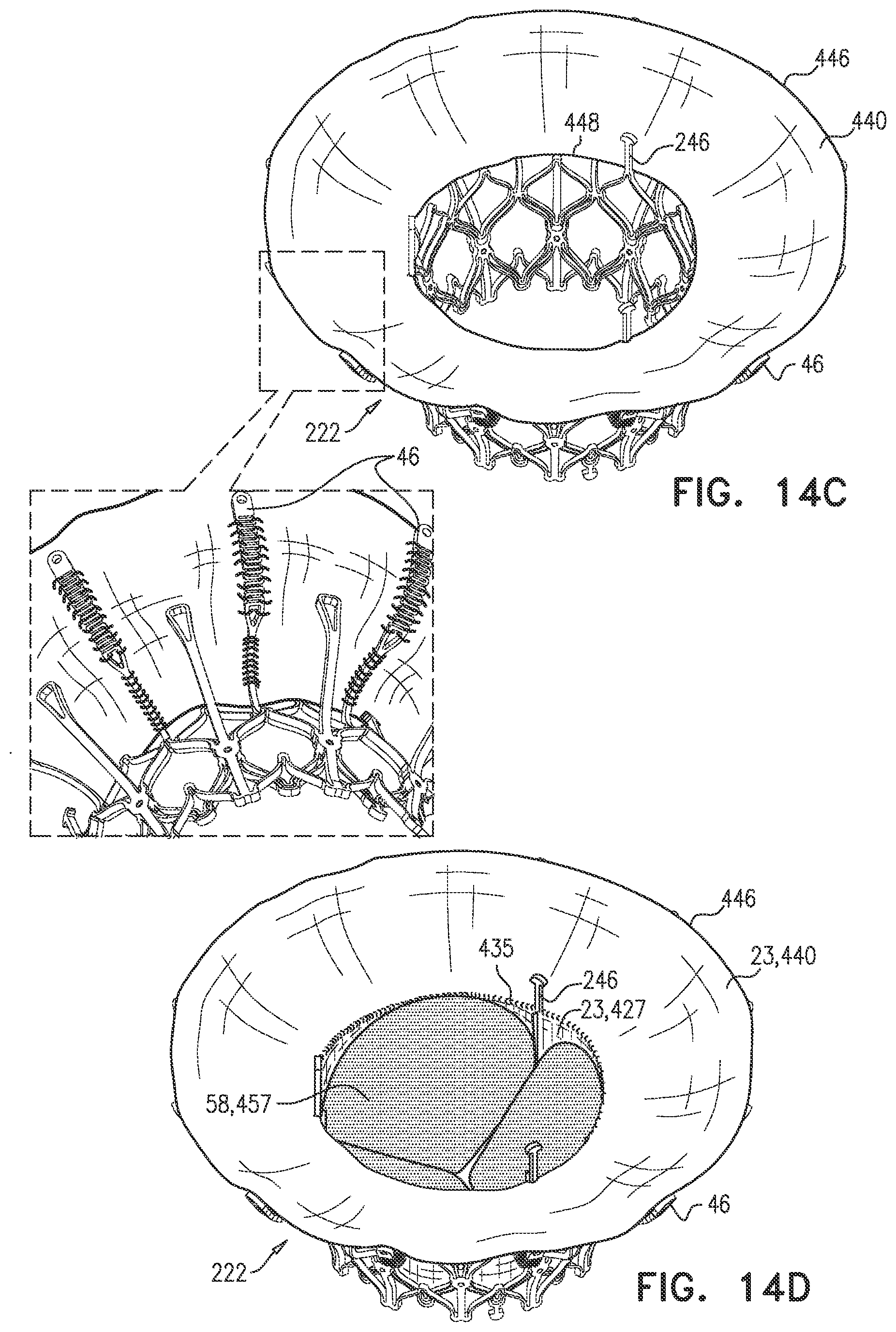 Patent US12090048 Figure 20 – Prosthetic heart valve