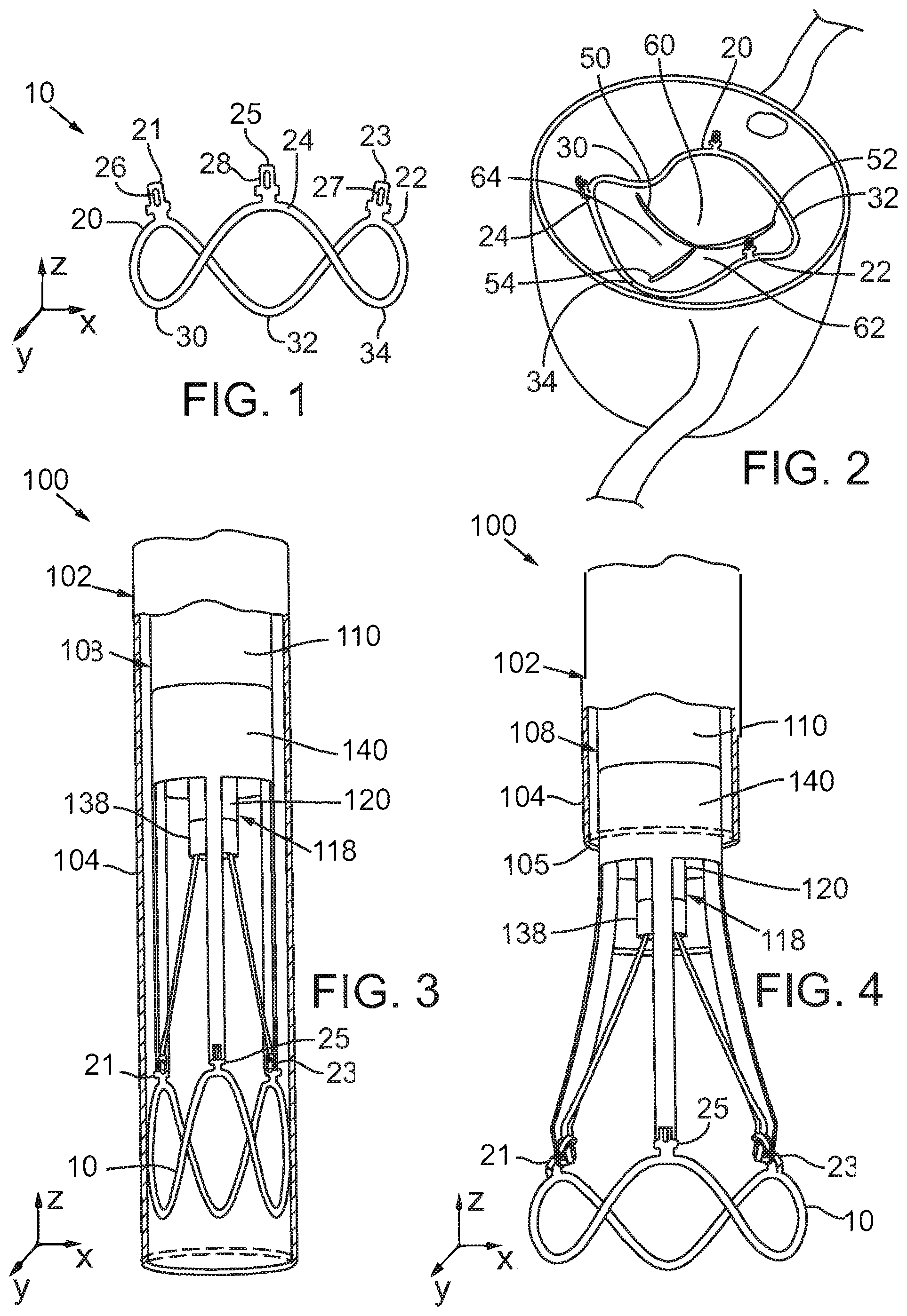 Patent US12090049 Figure 1 – Retaining mechanisms for prosthetic valves