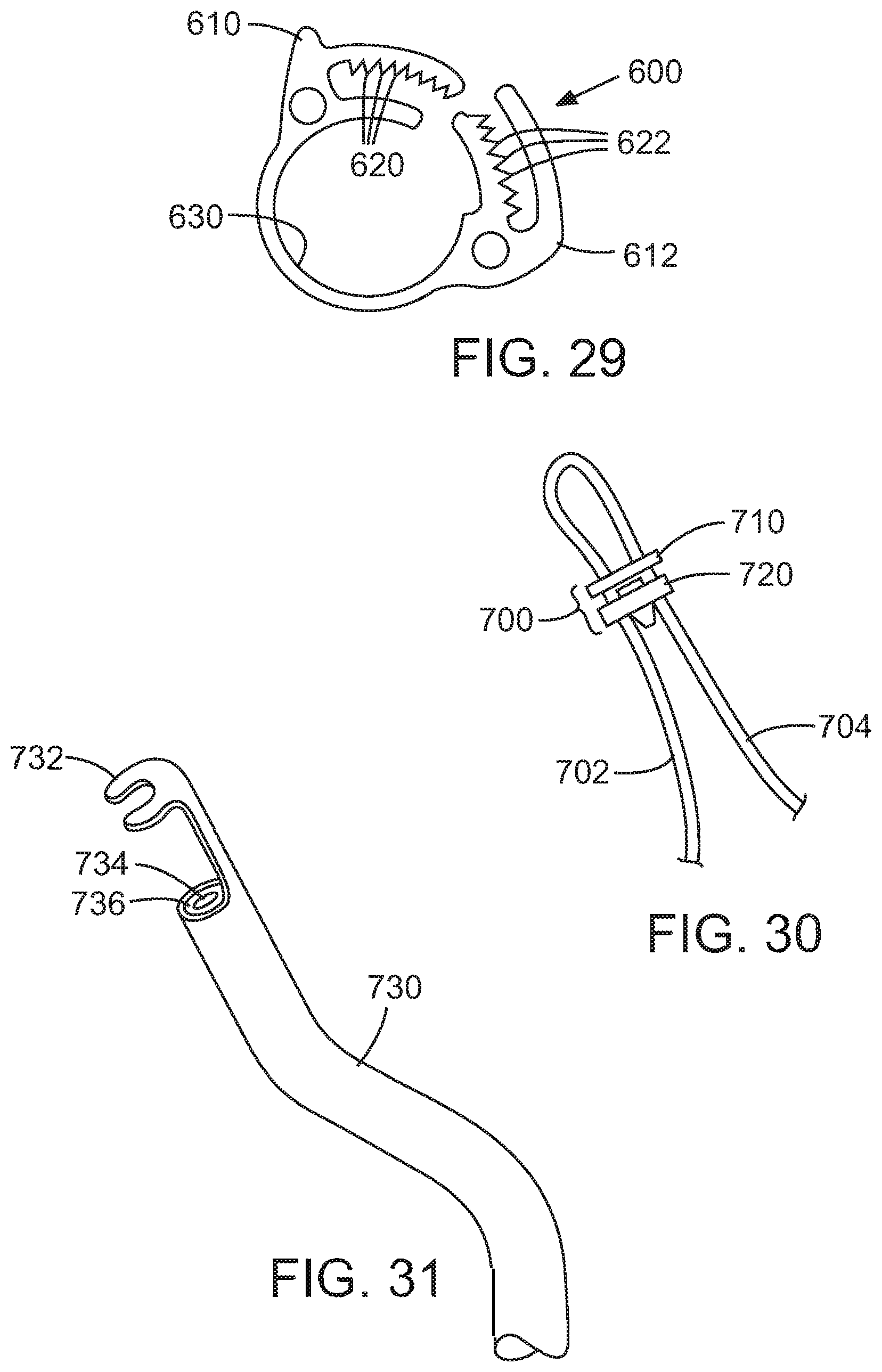 Patent US12090049 Figure 16 – Retaining mechanisms for prosthetic valves