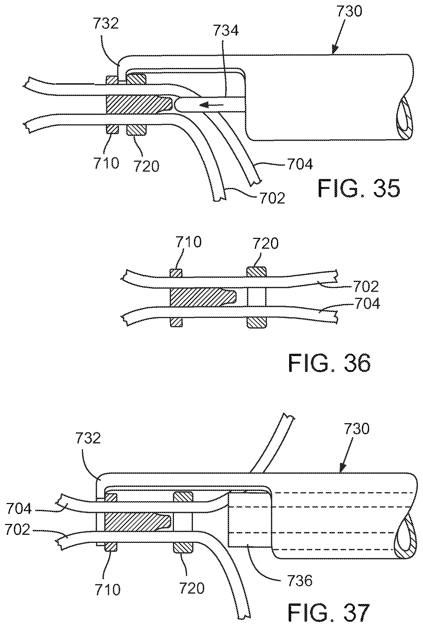 Patent US12090049 Figure 18 – Retaining mechanisms for prosthetic valves