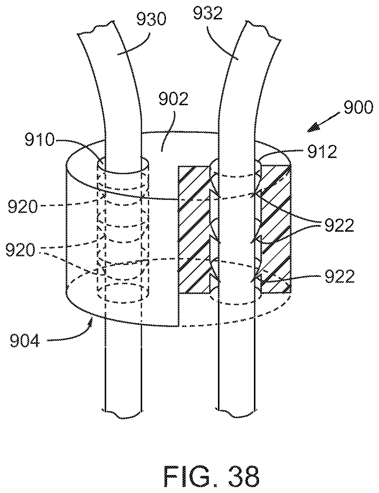 Patent US12090049 Figure 19 – Retaining mechanisms for prosthetic valves