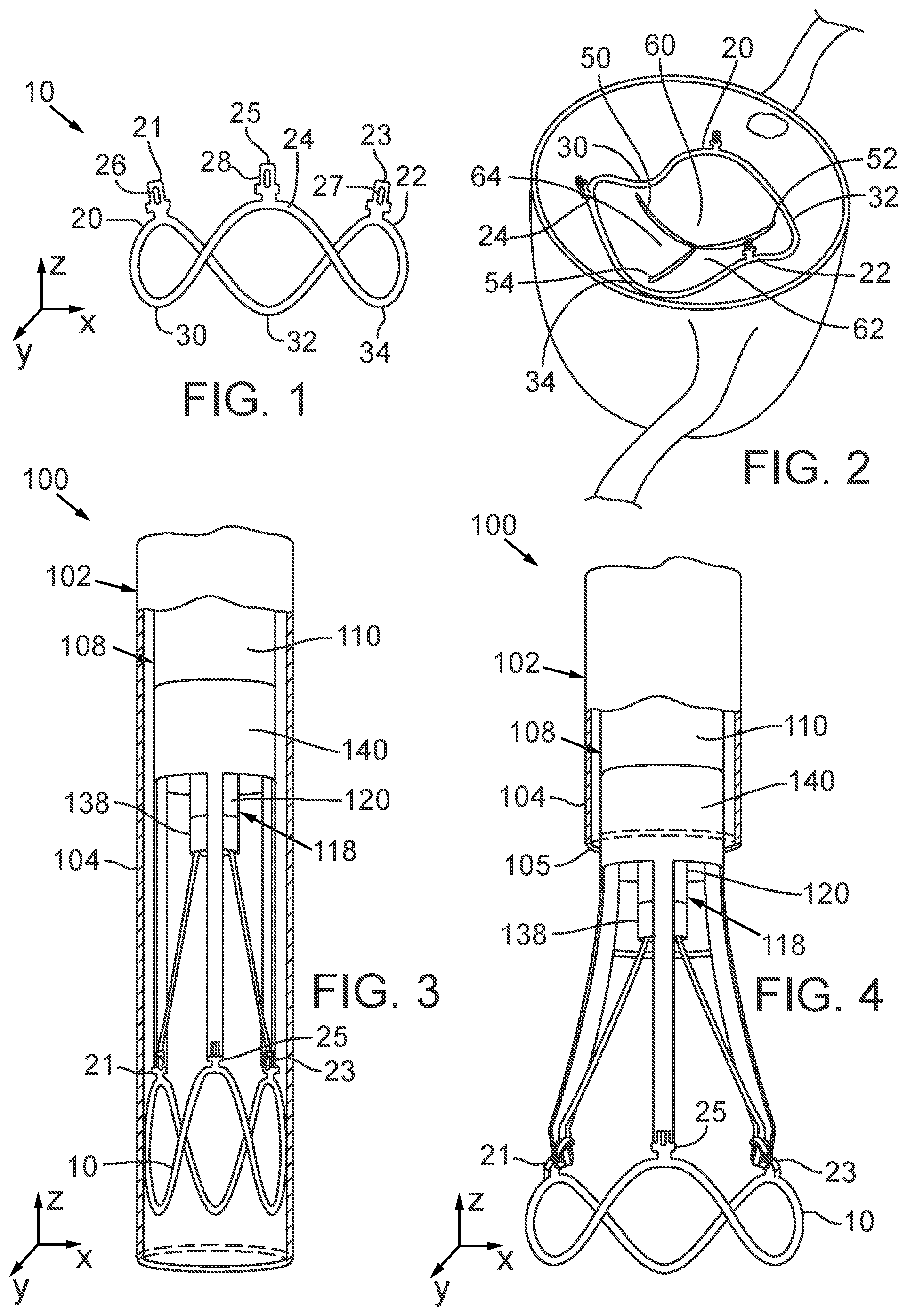Patent US12090050 Figure 1 – Method for delivering a support member to a native heart valve