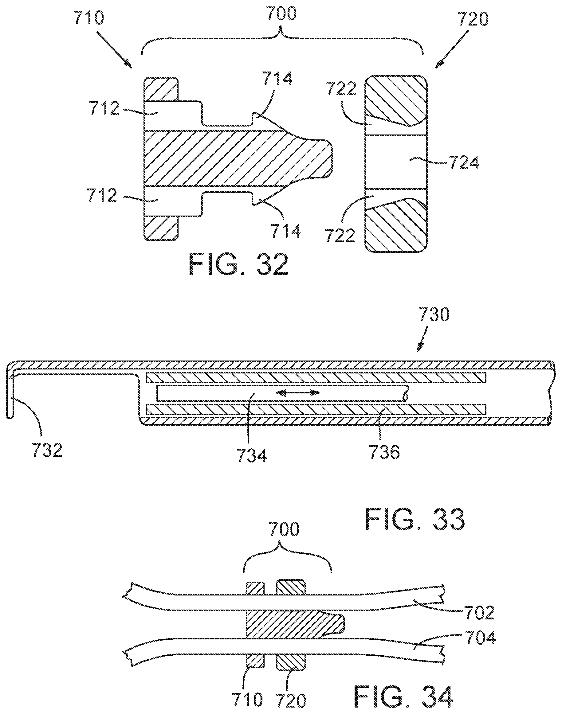 Patent US12090050 Figure 17 – Method for delivering a support member to a native heart valve