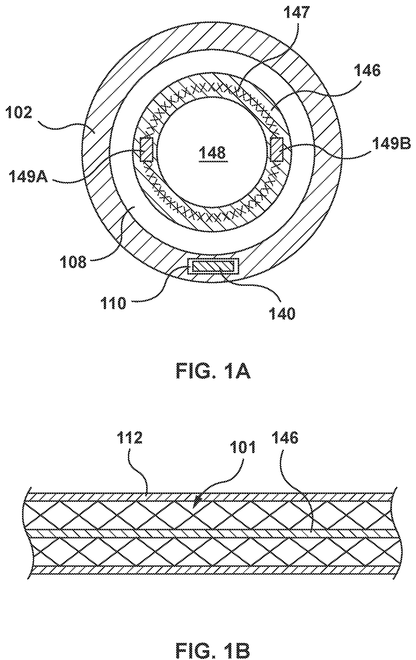 Patent US12090051 Figure 2 – Delivery device having a capsule for delivering a prosthesis and a pull wire for steering the capsule