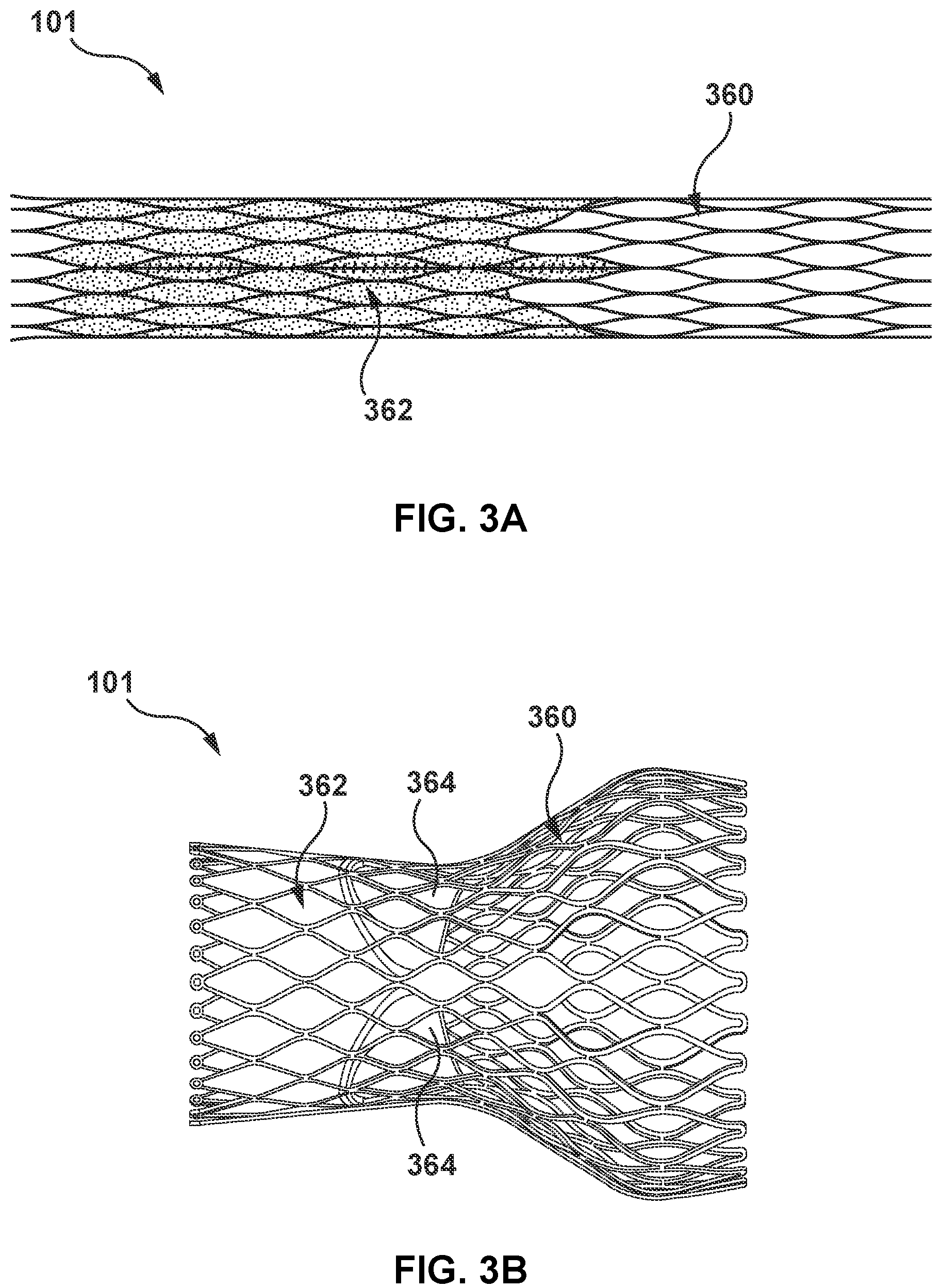 Patent US12090051 Figure 3 – Delivery device having a capsule for delivering a prosthesis and a pull wire for steering the capsule
