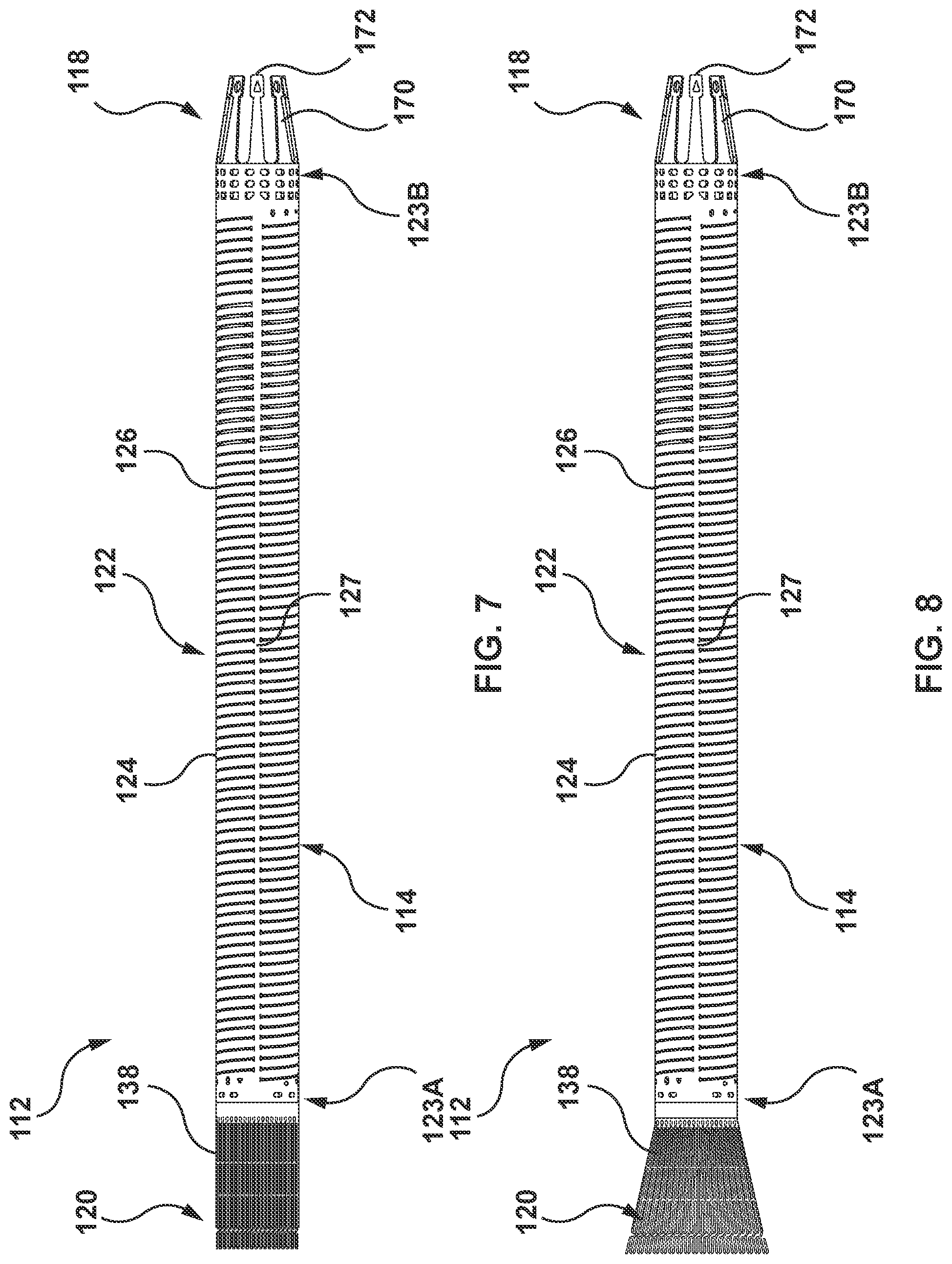Patent US12090051 Figure 6 – Delivery device having a capsule for delivering a prosthesis and a pull wire for steering the capsule