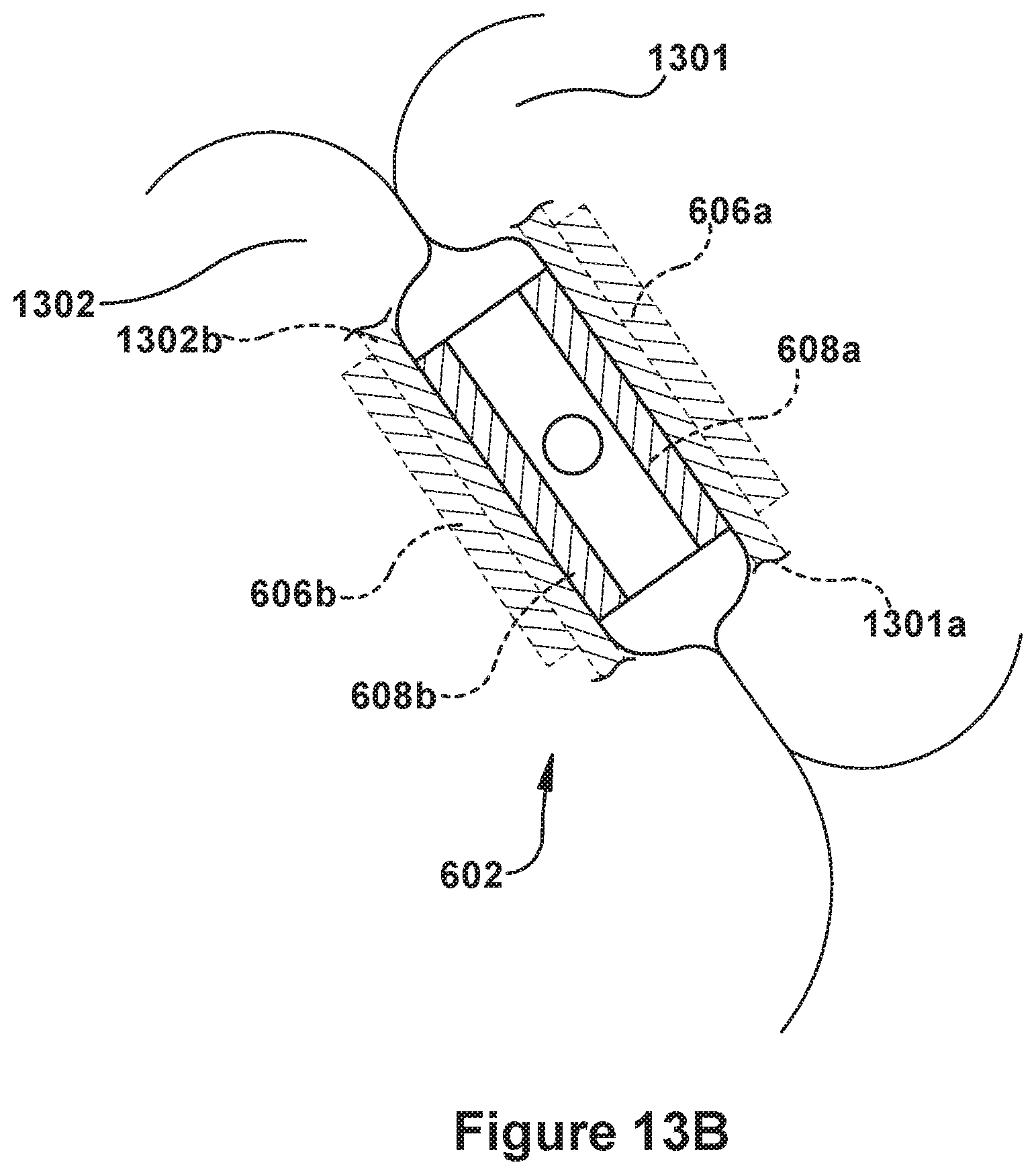 Patent US12090052 Figure 14 – Native valve repair devices and procedures