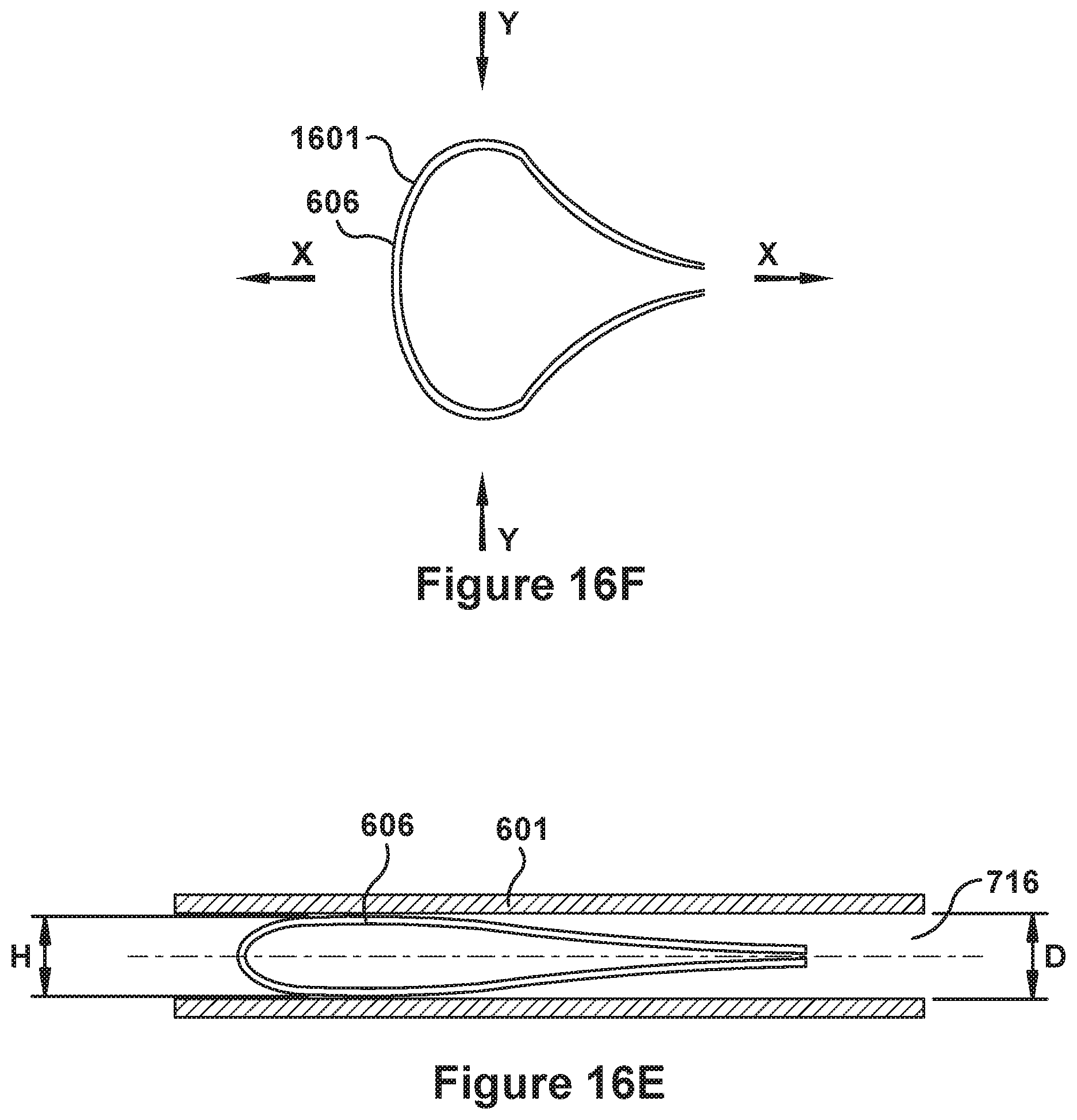 Patent US12090052 Figure 20 – Native valve repair devices and procedures
