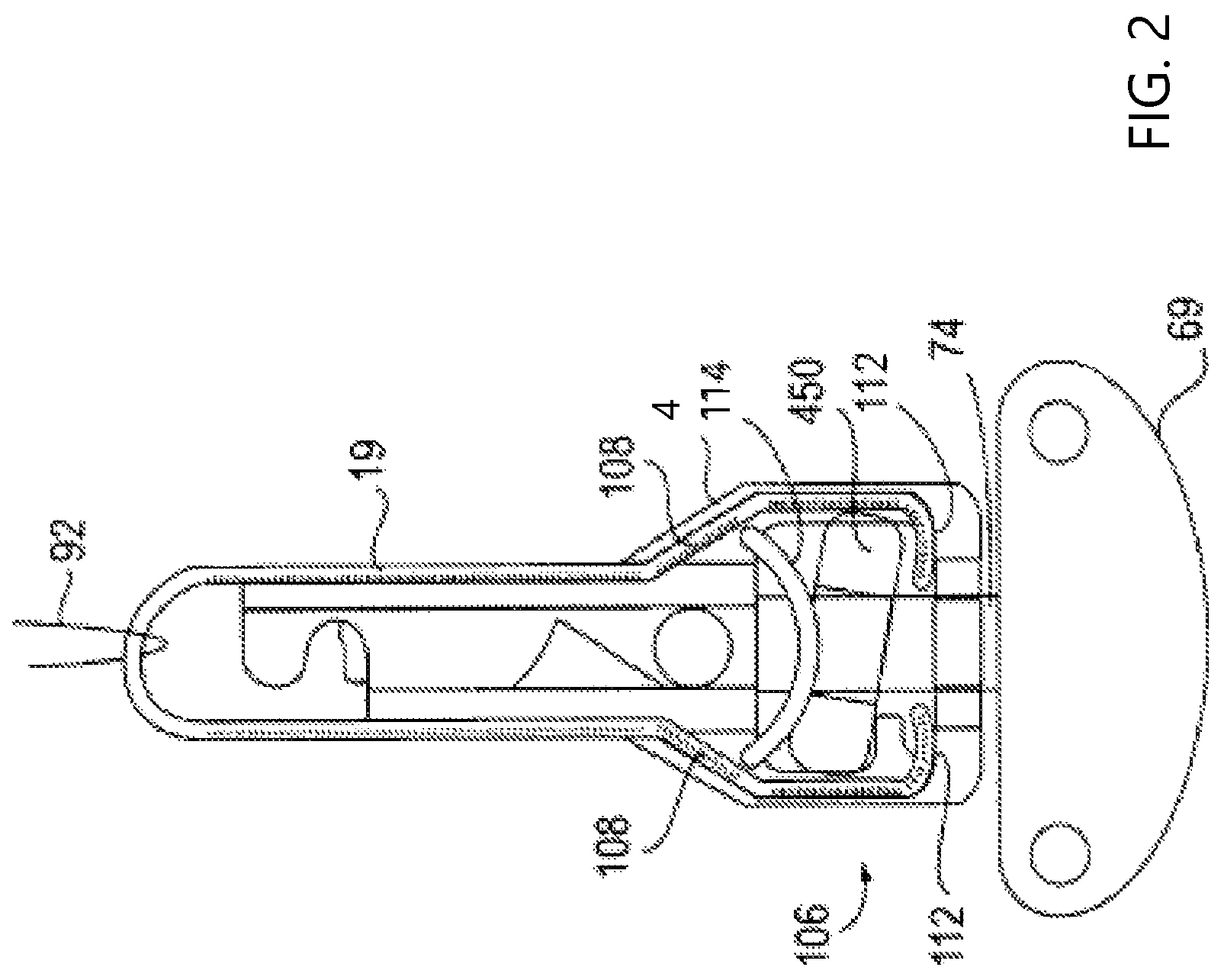 Patent US12090053 Figure 2 – Medical device delivery system with locking system