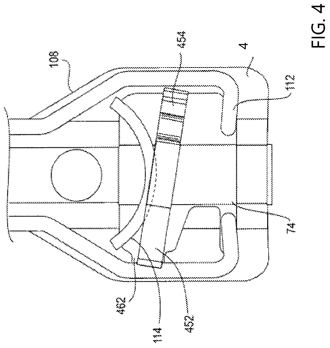 Patent US12090053 Figure 4 – Medical device delivery system with locking system