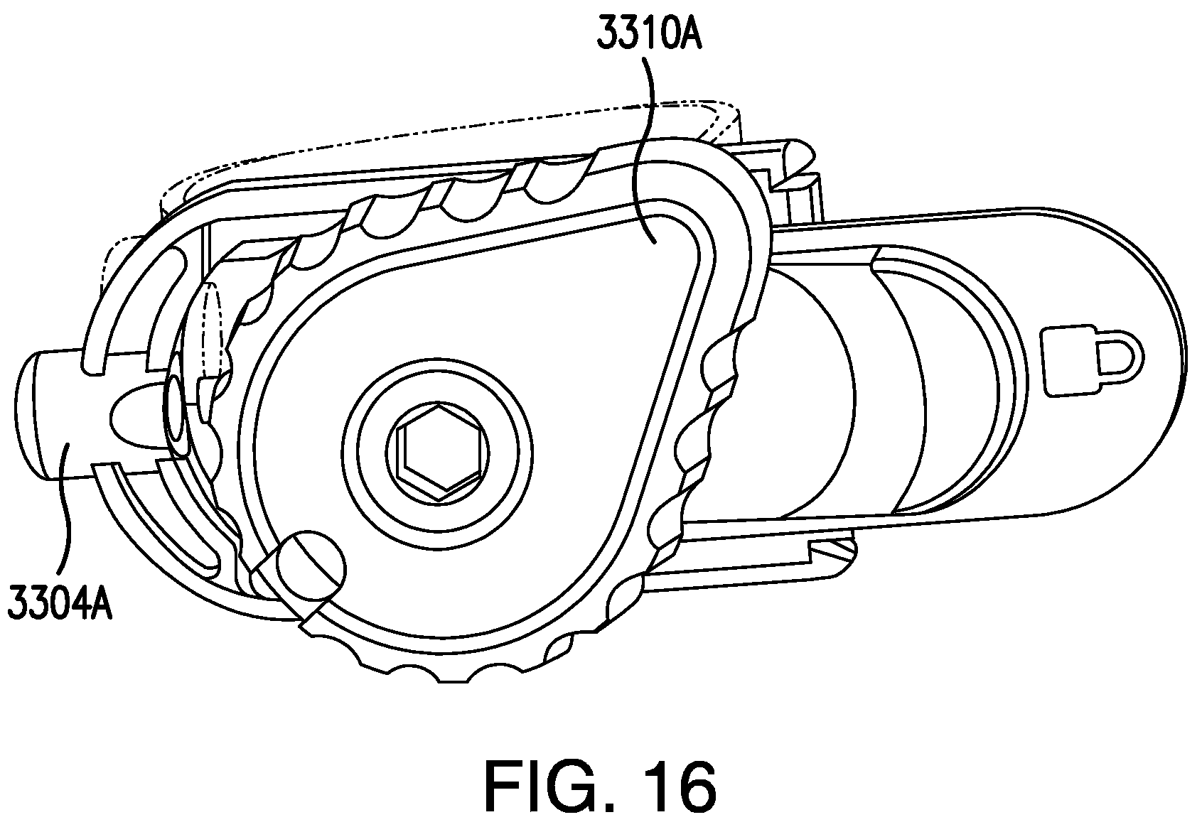 Patent US12090053 Figure 17 – Medical device delivery system with locking system