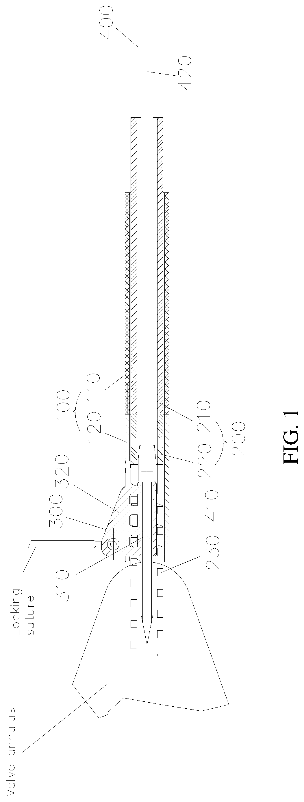 Patent US12090054 Figure 1 – Anchor delivery device for repairing heart valve