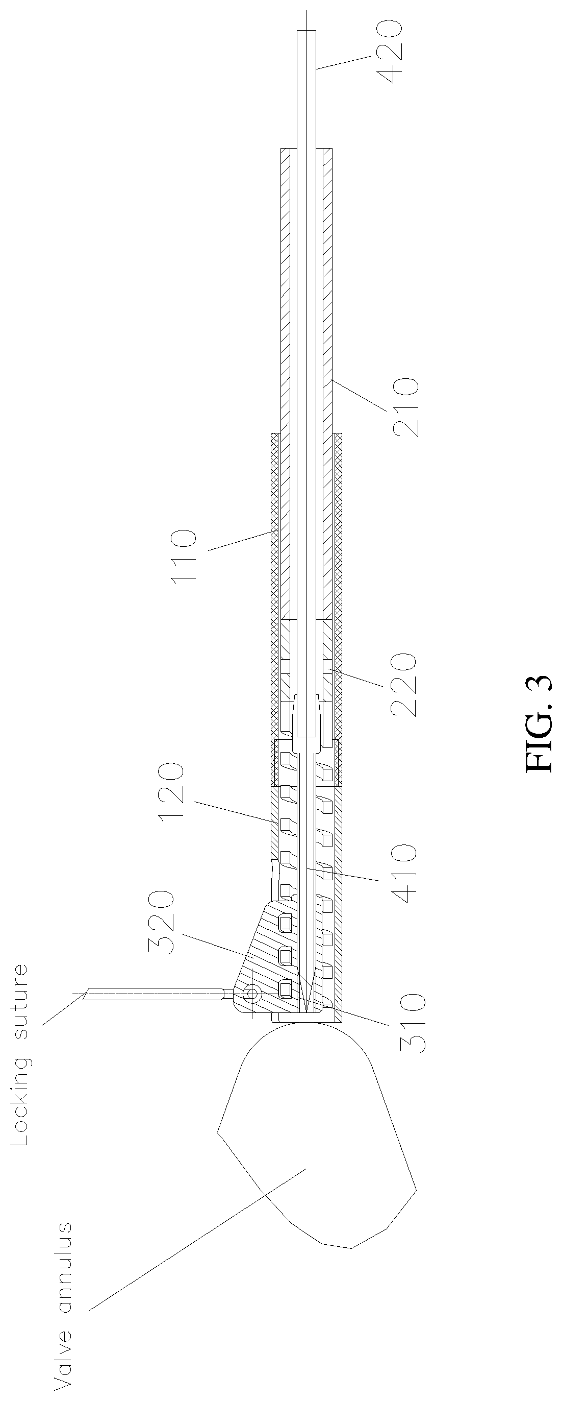 Patent US12090054 Figure 3 – Anchor delivery device for repairing heart valve
