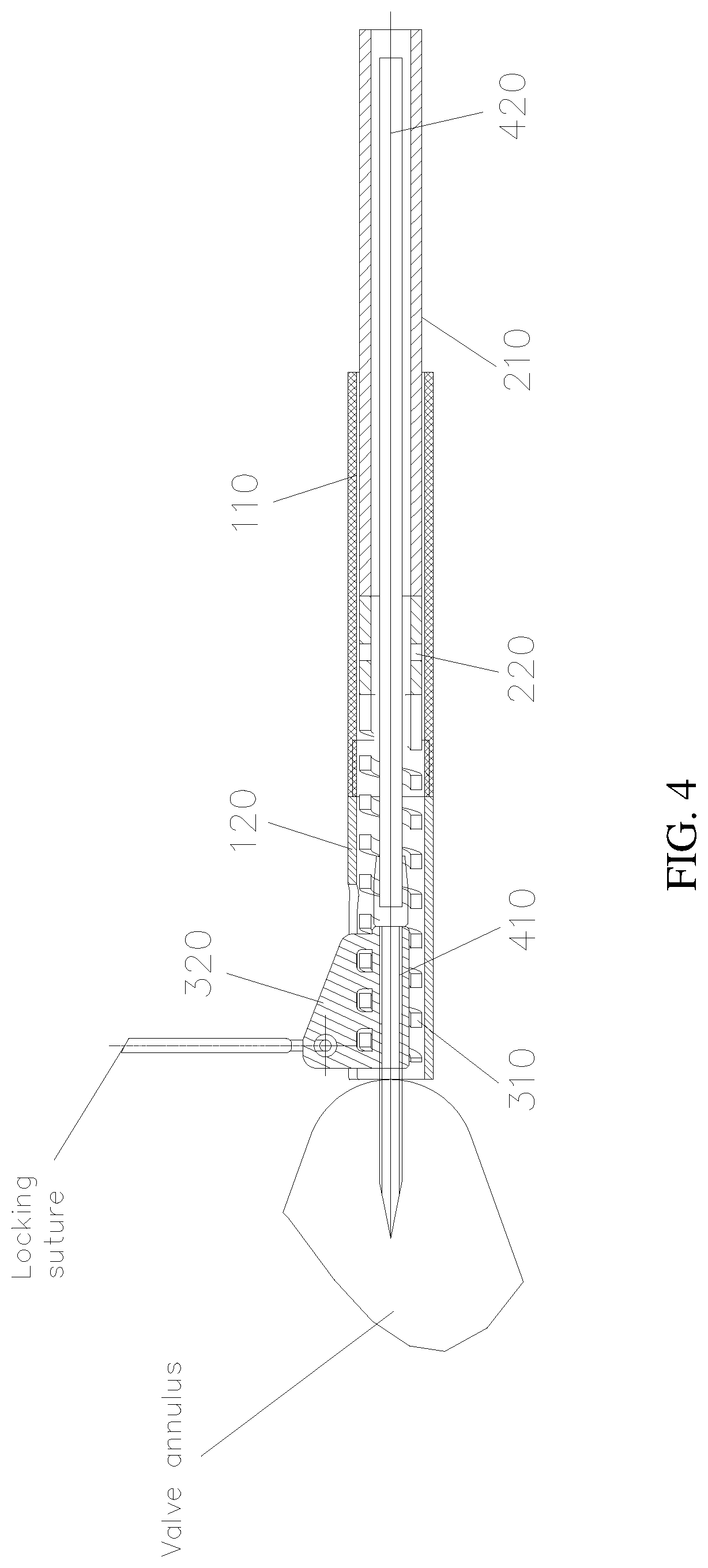 Patent US12090054 Figure 4 – Anchor delivery device for repairing heart valve