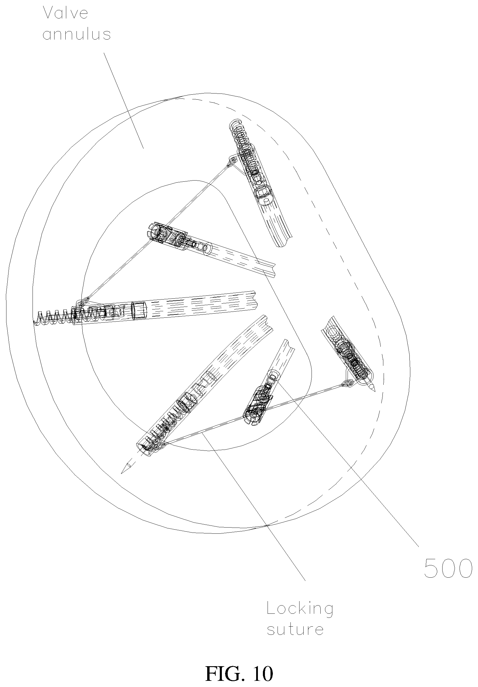 Patent US12090054 Figure 10 – Anchor delivery device for repairing heart valve