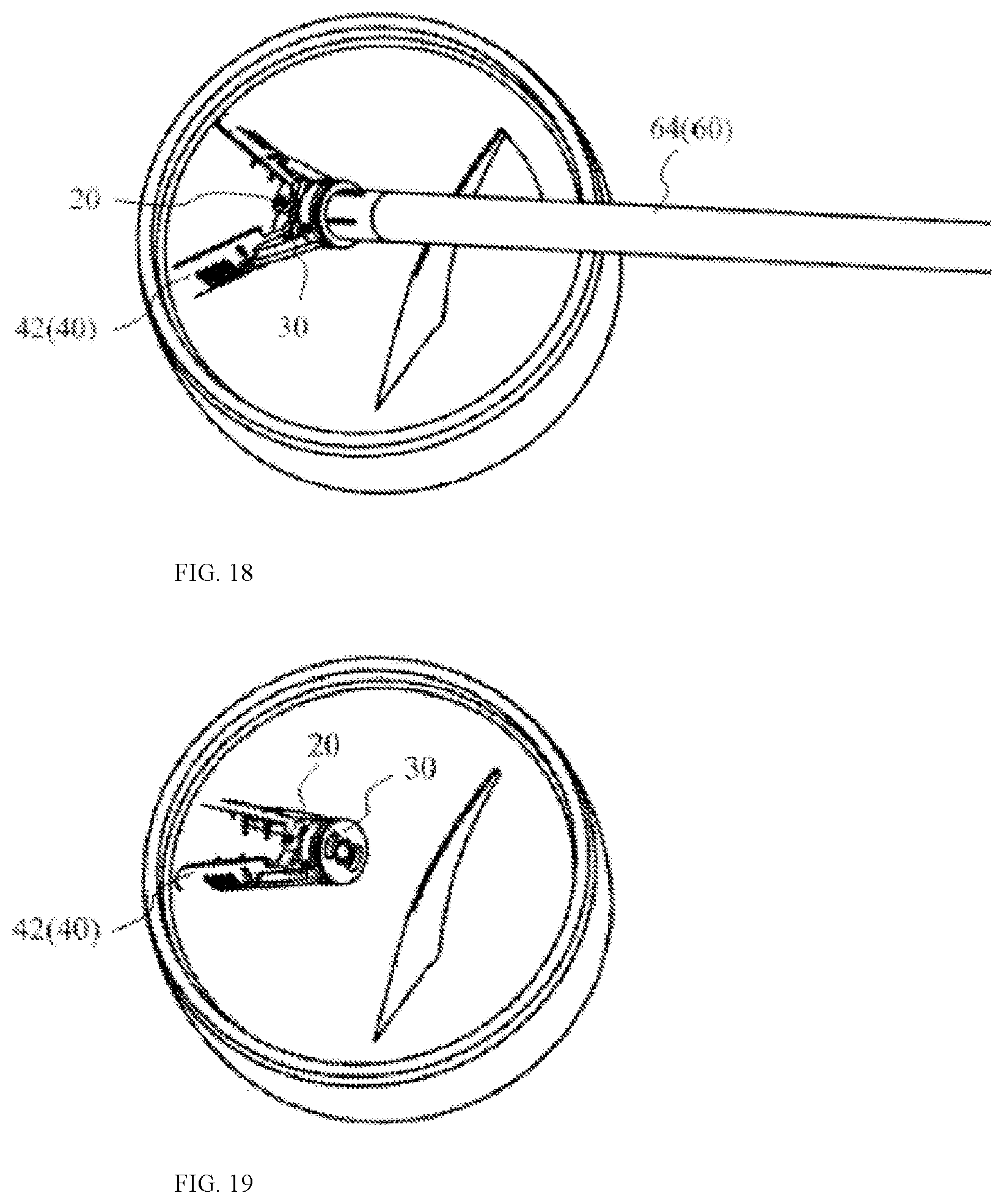Patent US12090055 Figure 13 – Clamping instrument