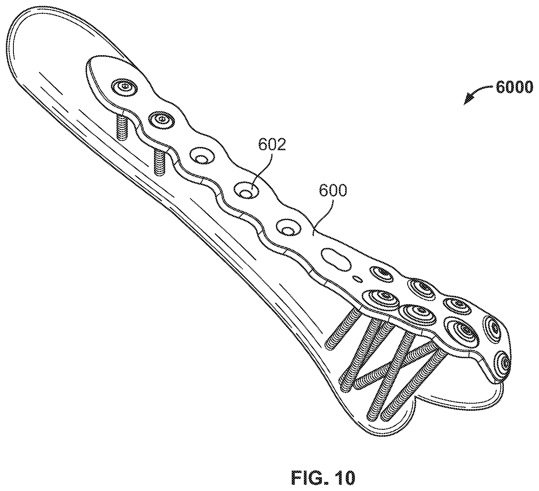 Patent US12090056 Figure 10 – Multi-stage additive manufacturing process with inserts