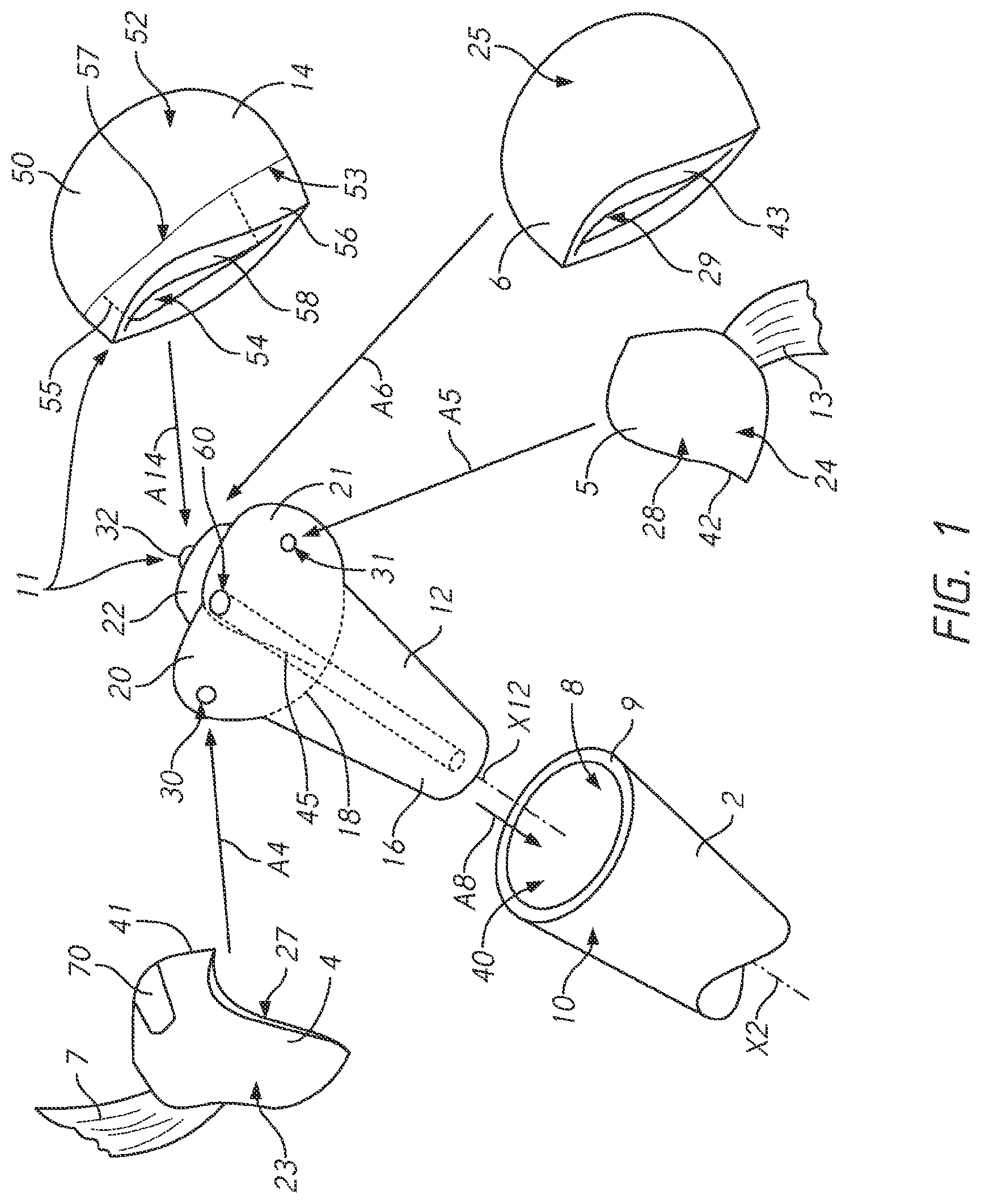 Patent US12090057 Figure 1 – Patient-specific bone fracture prostheses and methods of making the same