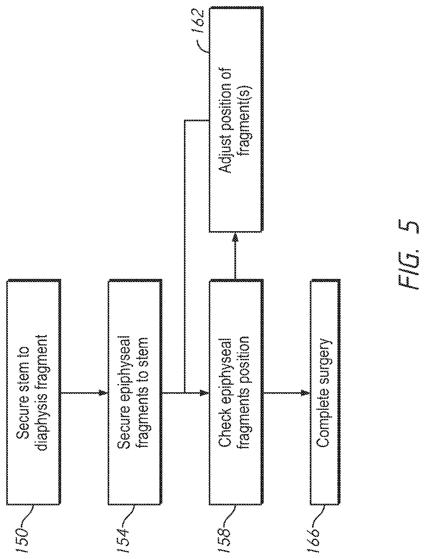 Patent US12090057 Figure 5 – Patient-specific bone fracture prostheses and methods of making the same