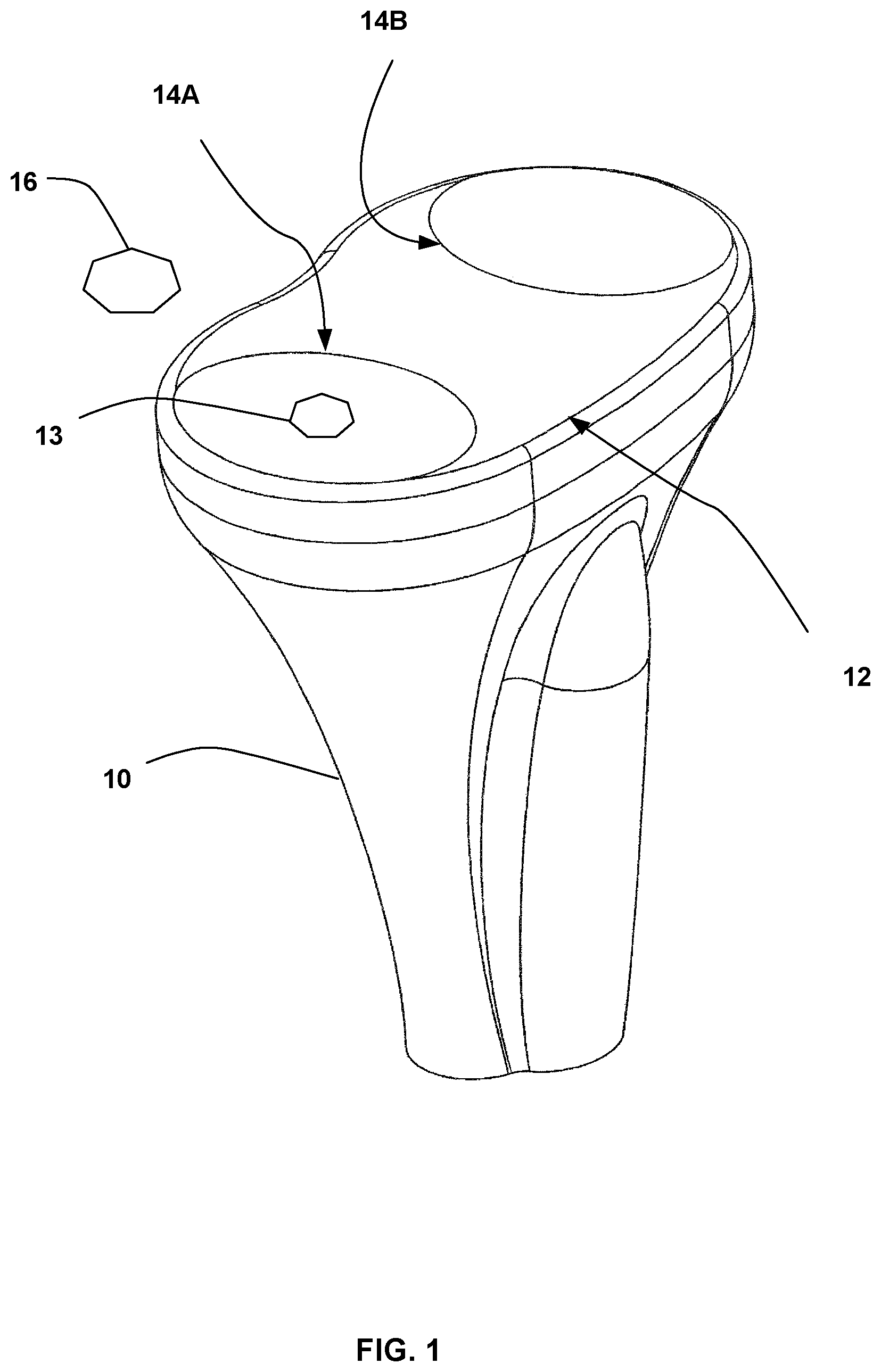 Patent US12090058 — Tibial resurfacing system and method — Figure 1