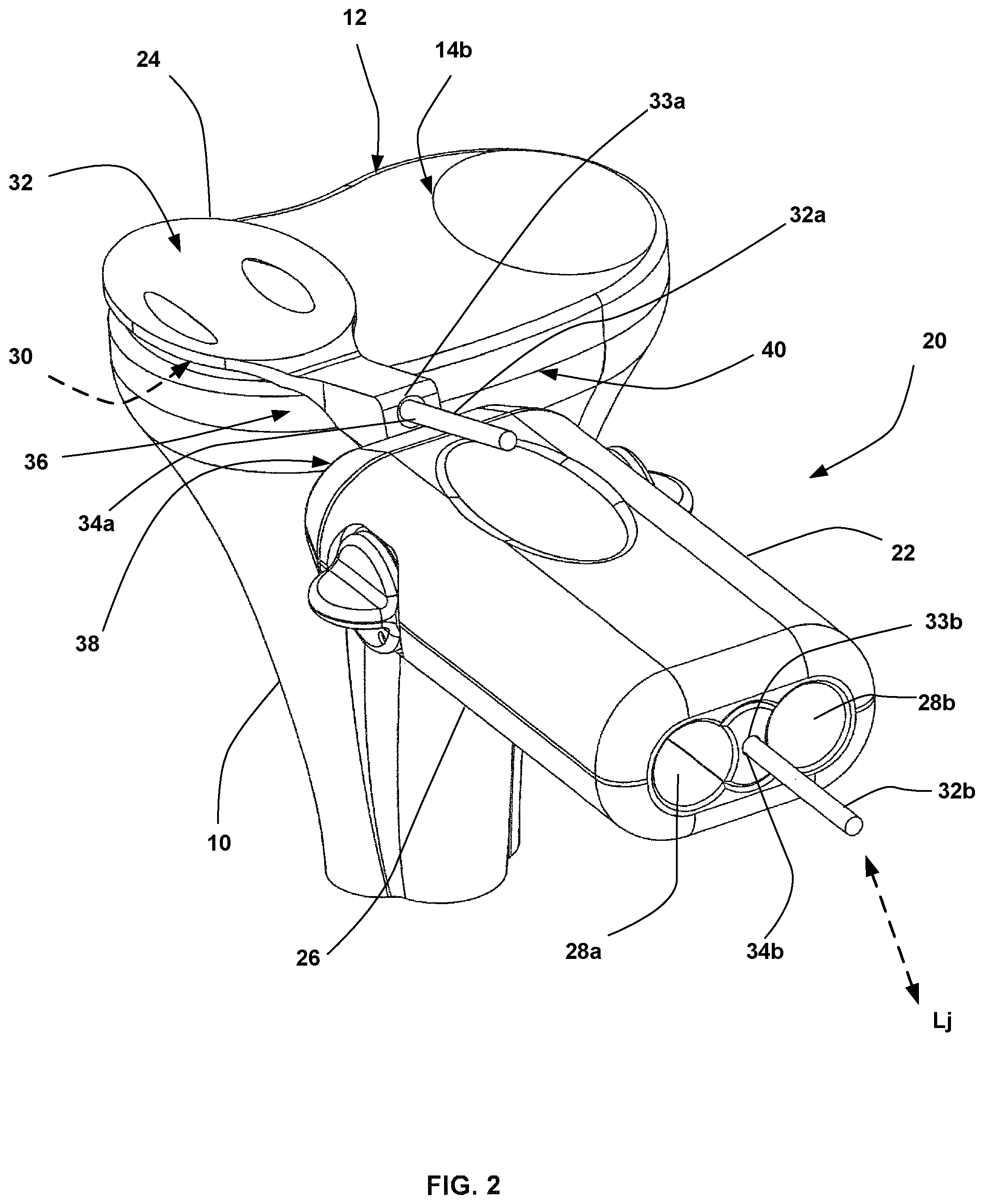 Patent US12090058 Figure 2 – Tibial resurfacing system and method