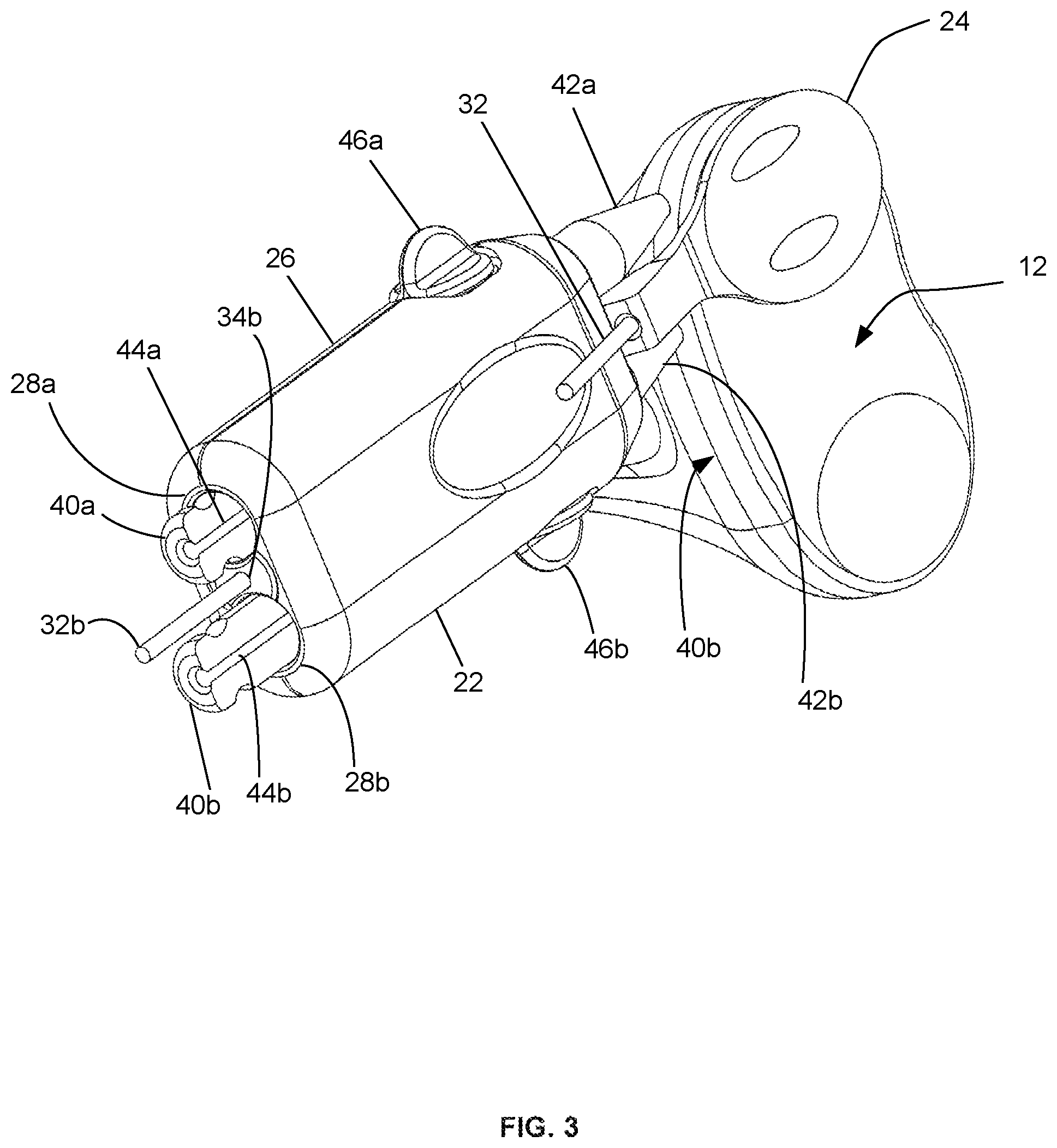 Patent US12090058 Figure 3 – Tibial resurfacing system and method