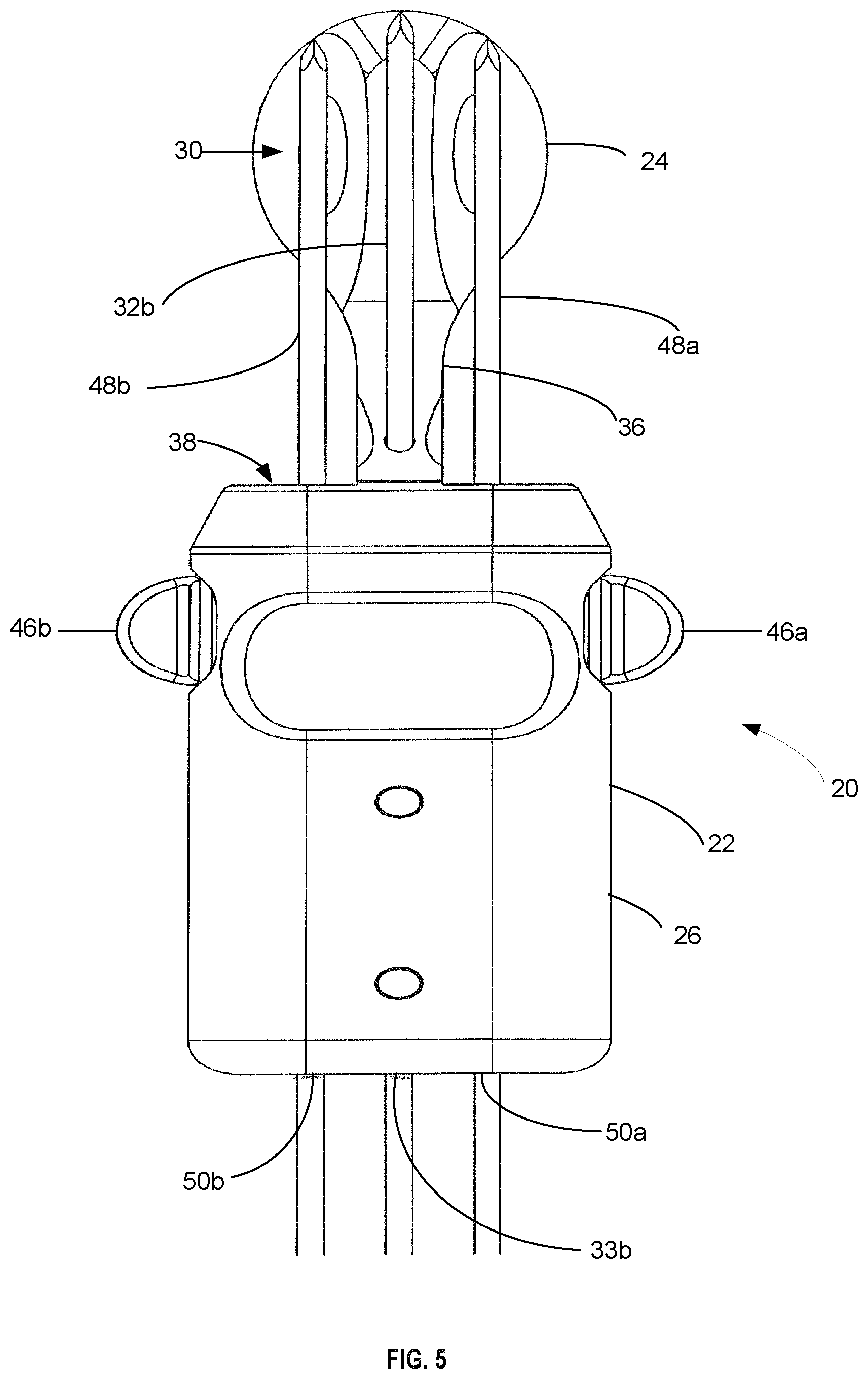 Patent US12090058 Figure 5 – Tibial resurfacing system and method