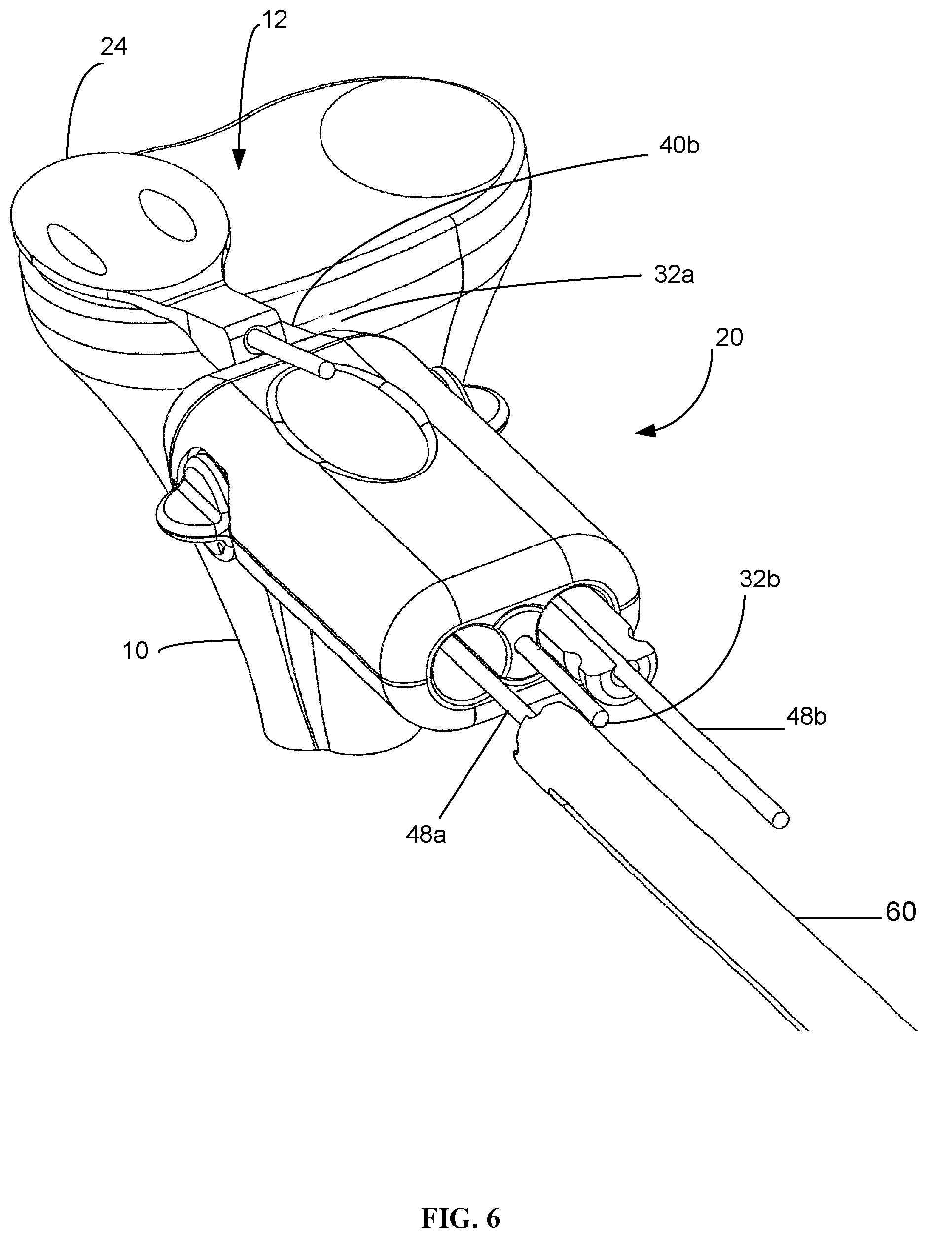 Patent US12090058 Figure 6 – Tibial resurfacing system and method