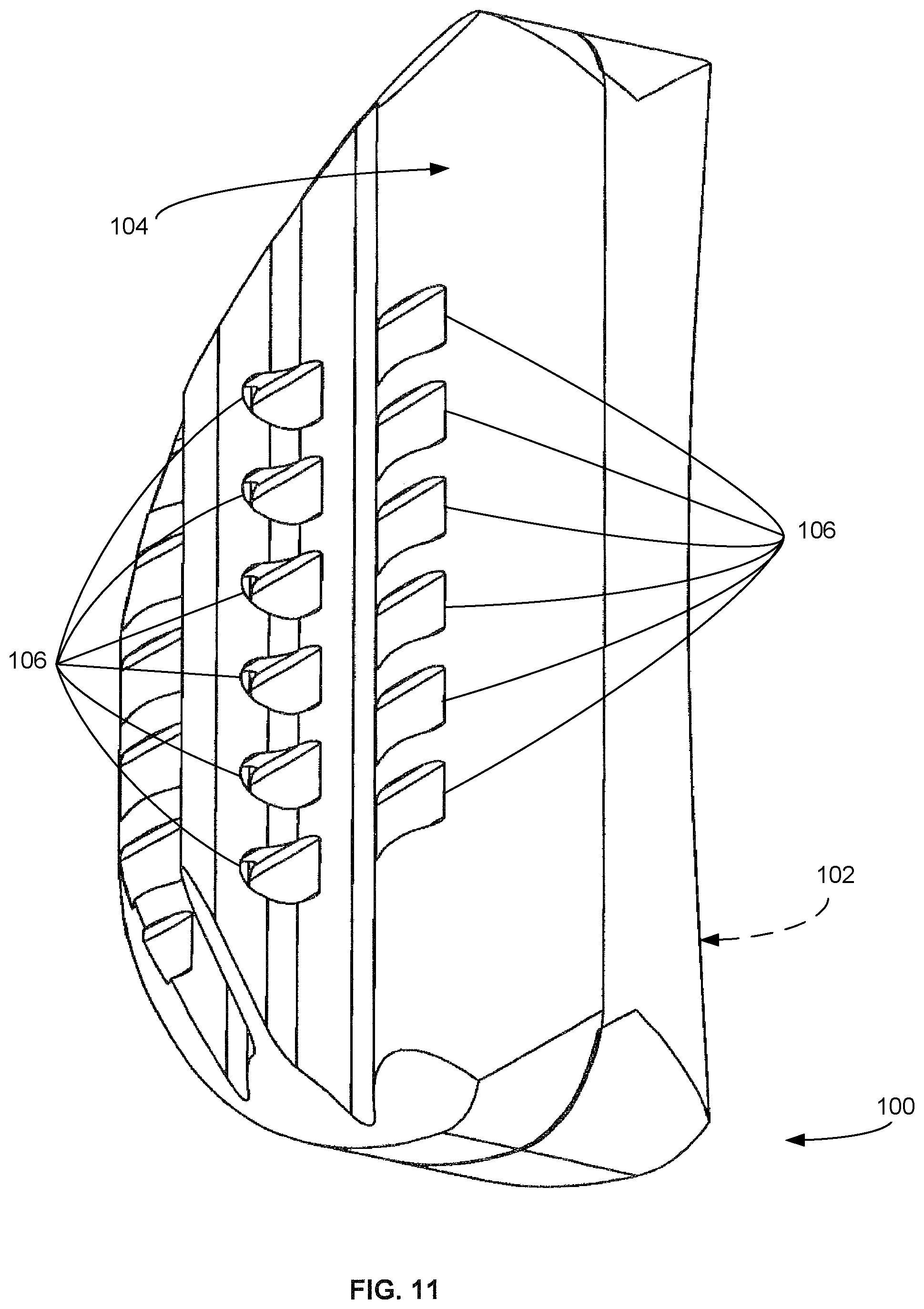 Patent US12090058 Figure 11 – Tibial resurfacing system and method