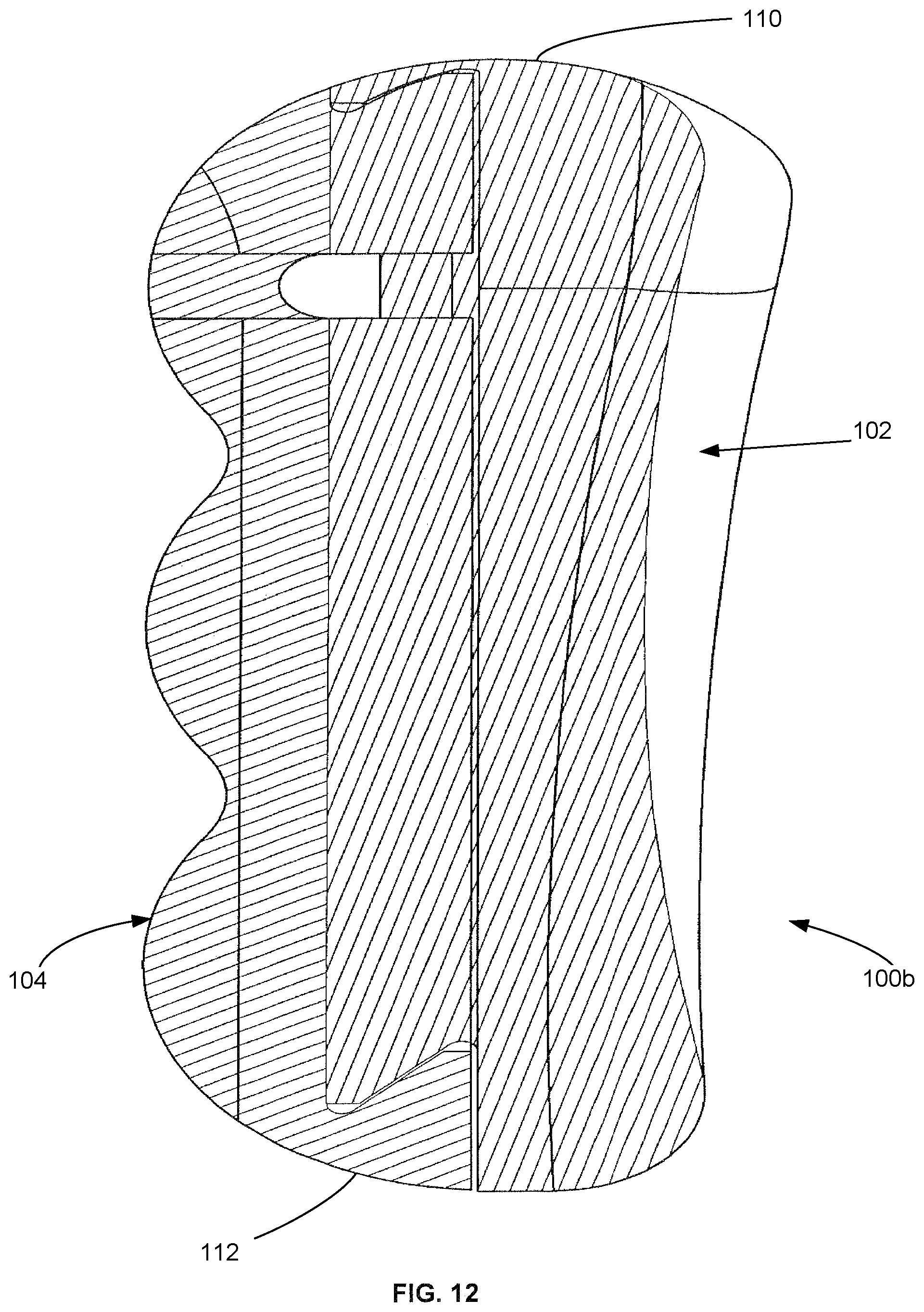 Patent US12090058 Figure 12 – Tibial resurfacing system and method
