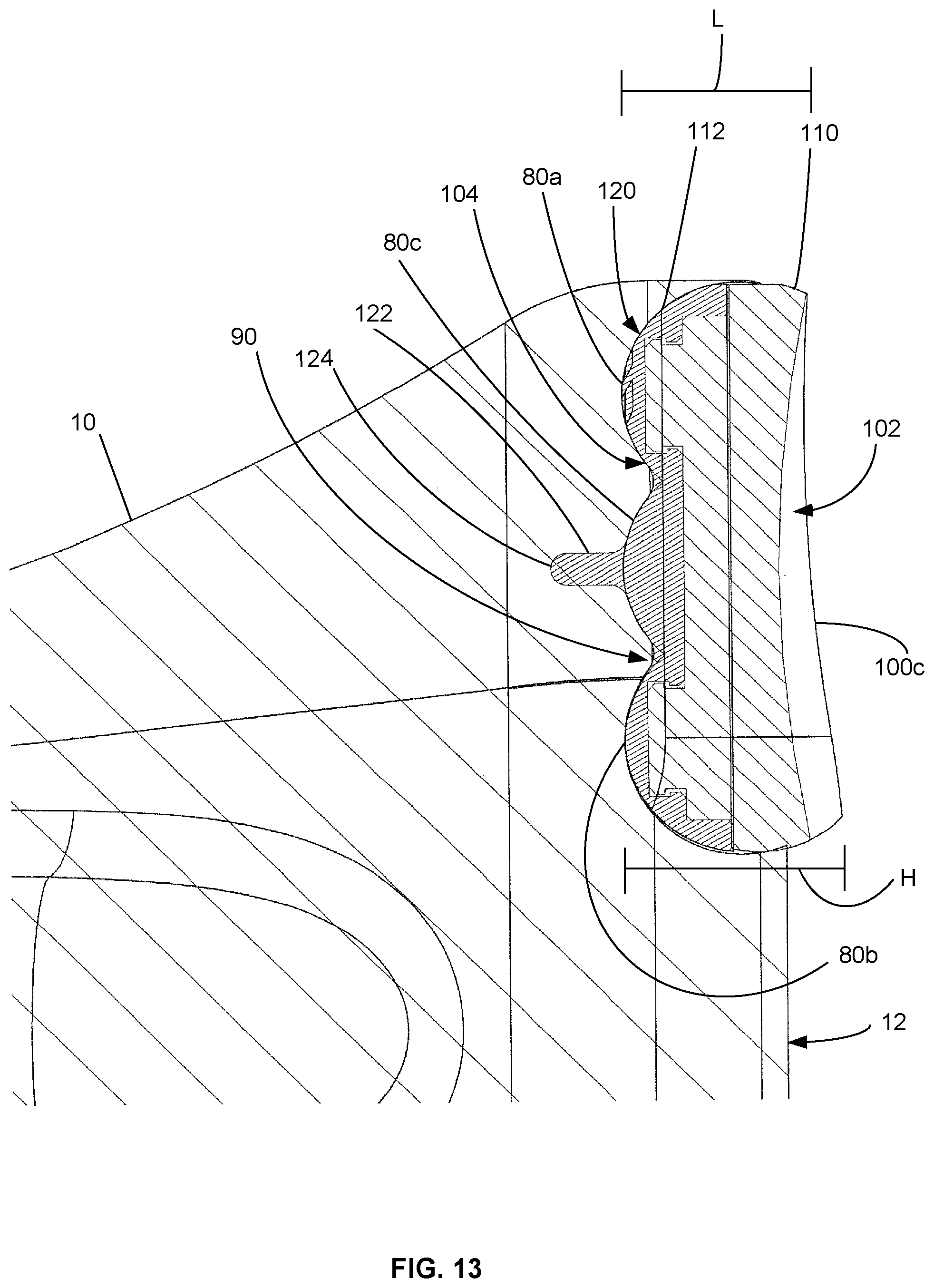 Patent US12090058 Figure 13 – Tibial resurfacing system and method