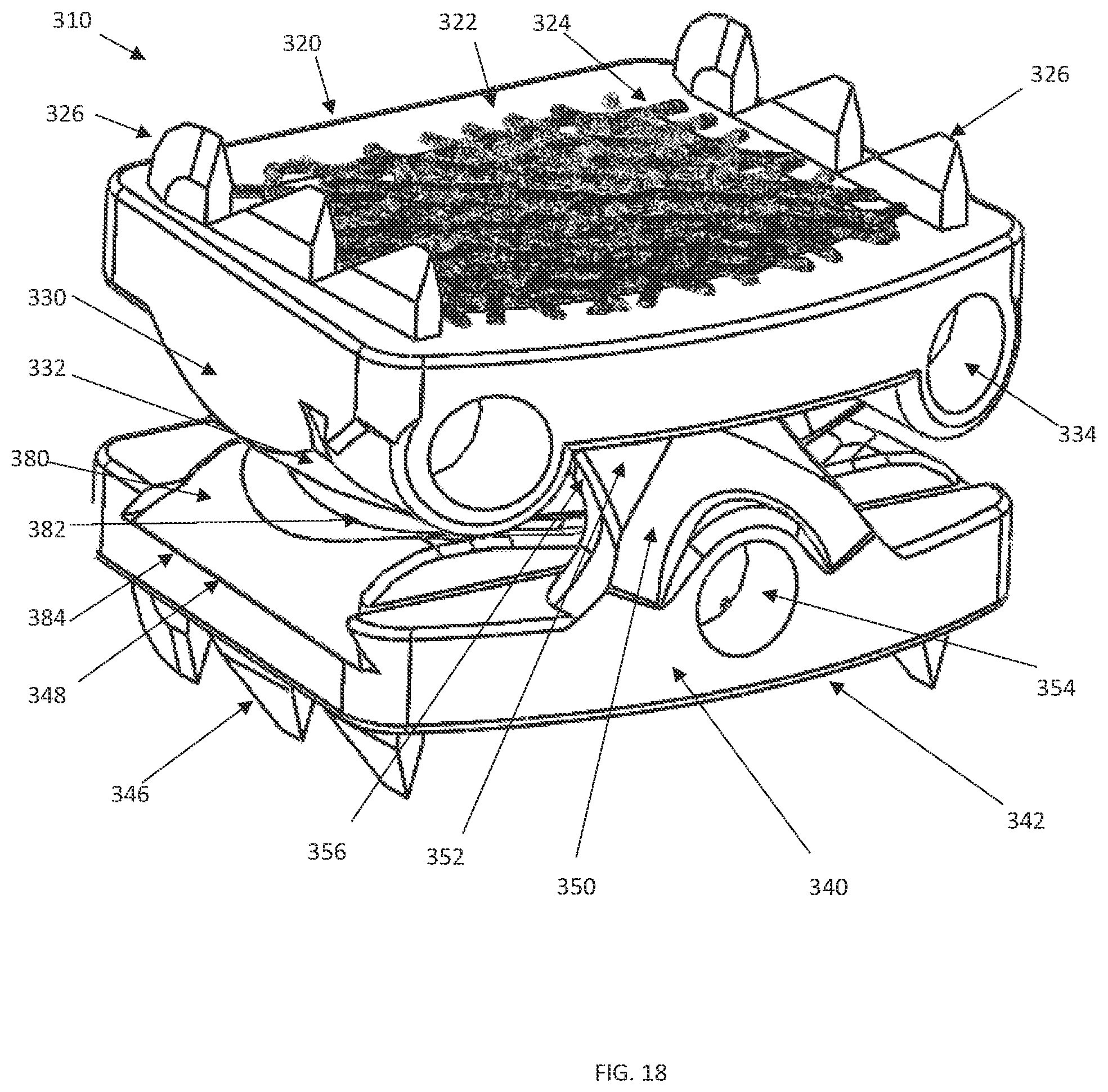 Patent US12090059 Figure 15 – Interlocking spinal disc prosthetic