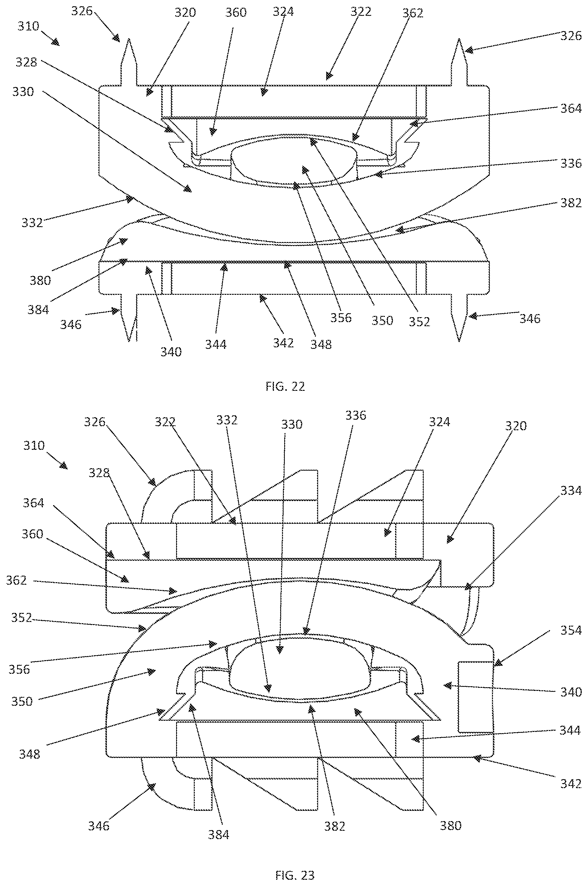 Patent US12090059 Figure 18 – Interlocking spinal disc prosthetic