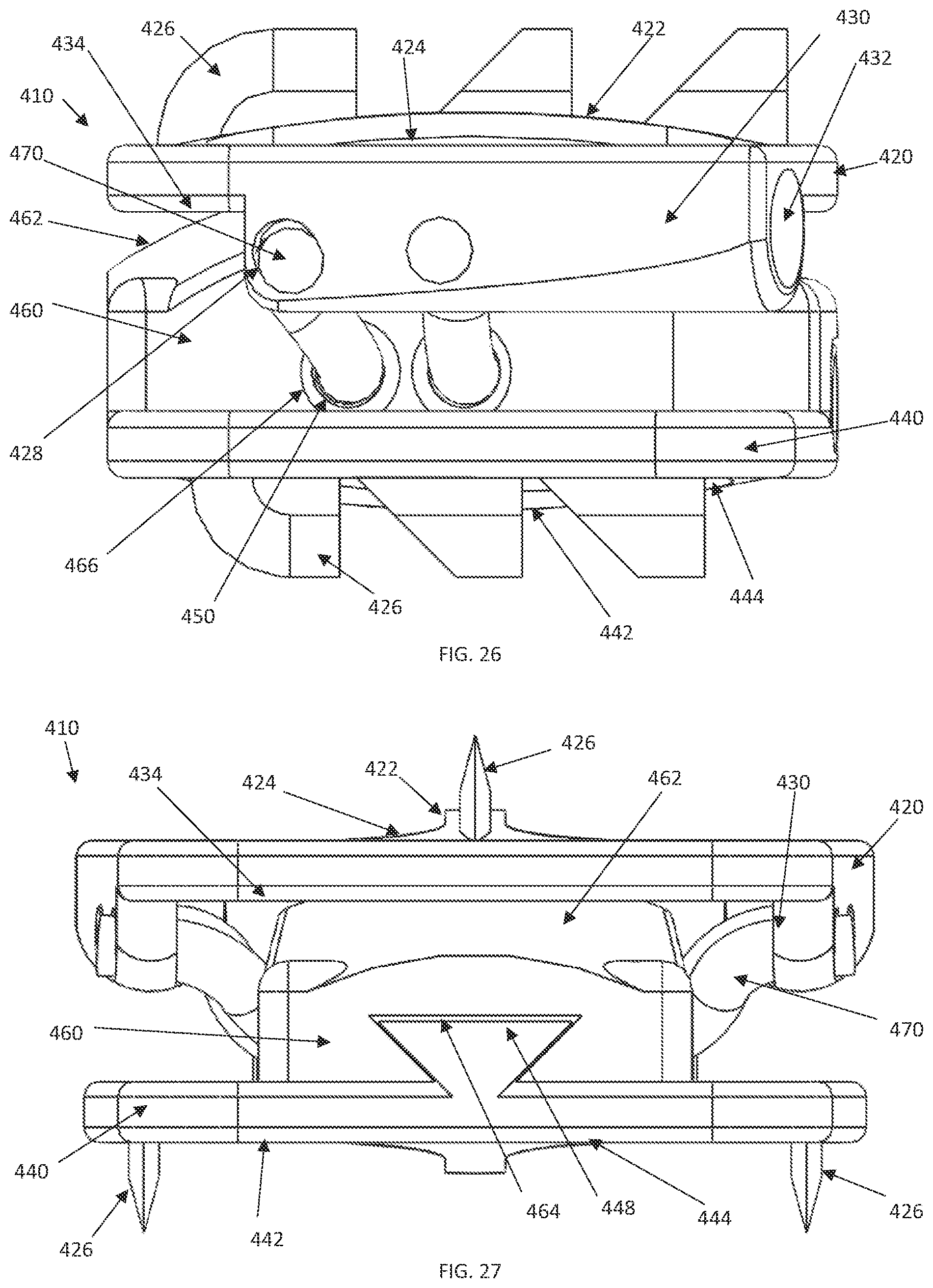 Patent US12090059 Figure 20 – Interlocking spinal disc prosthetic