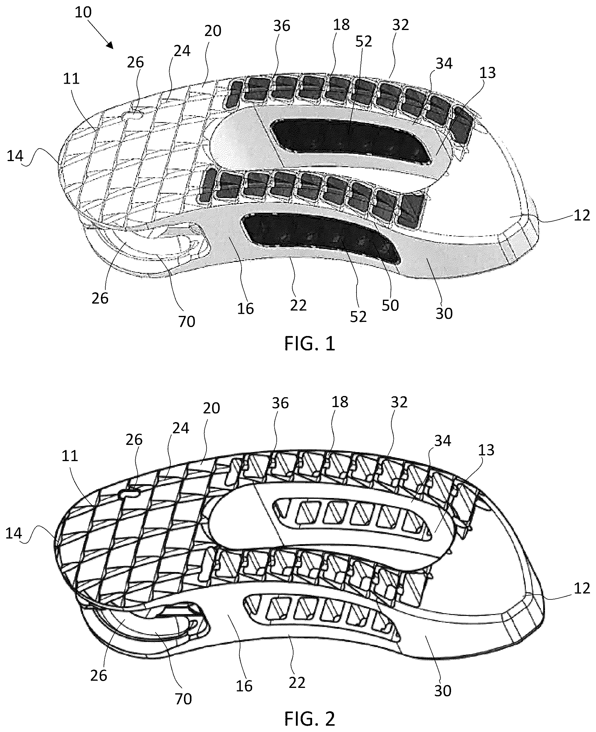 Patent US12090060 Figure 1 – Inter vertebral spinal implant