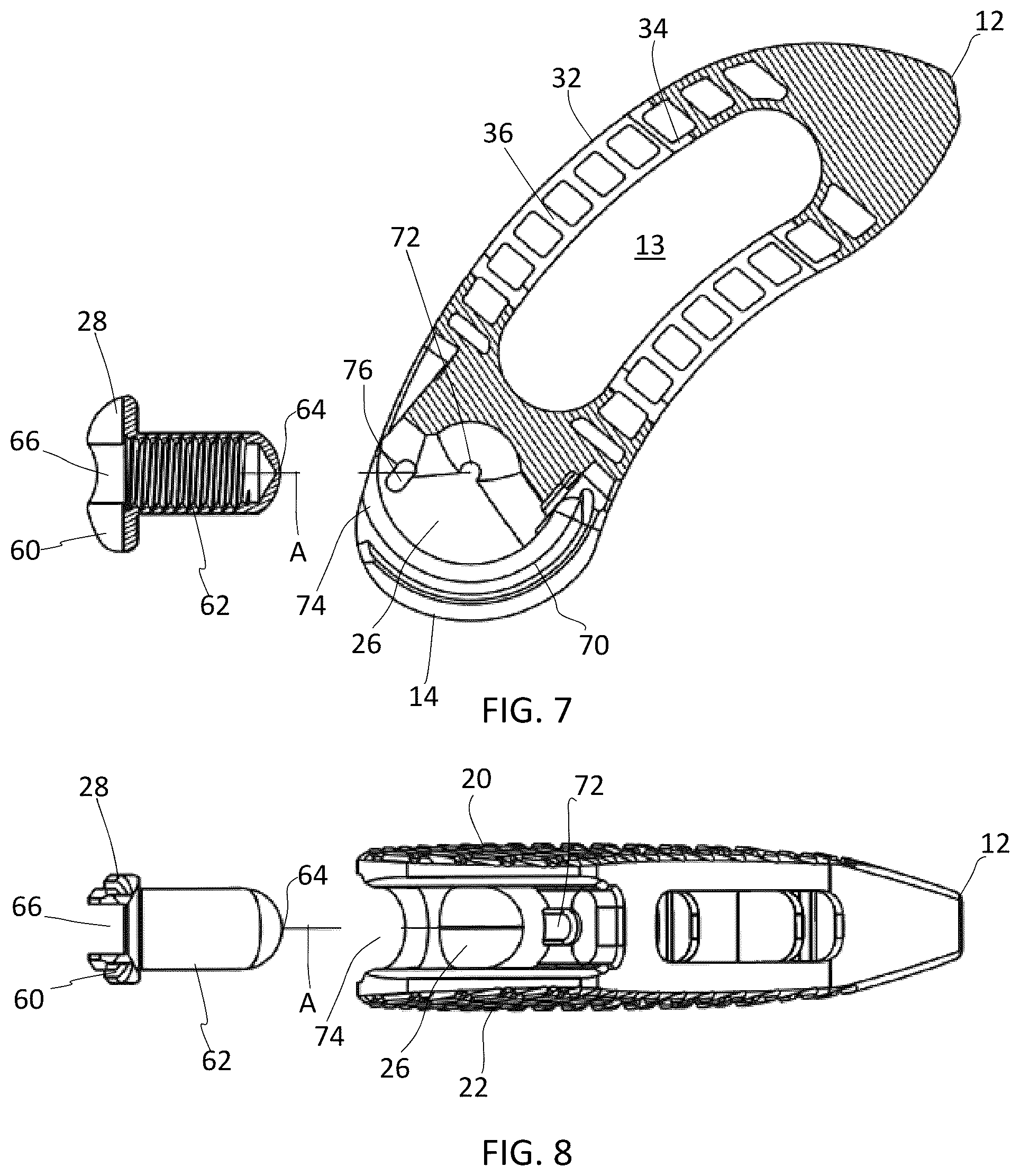 Patent US12090060 Figure 3 – Inter vertebral spinal implant