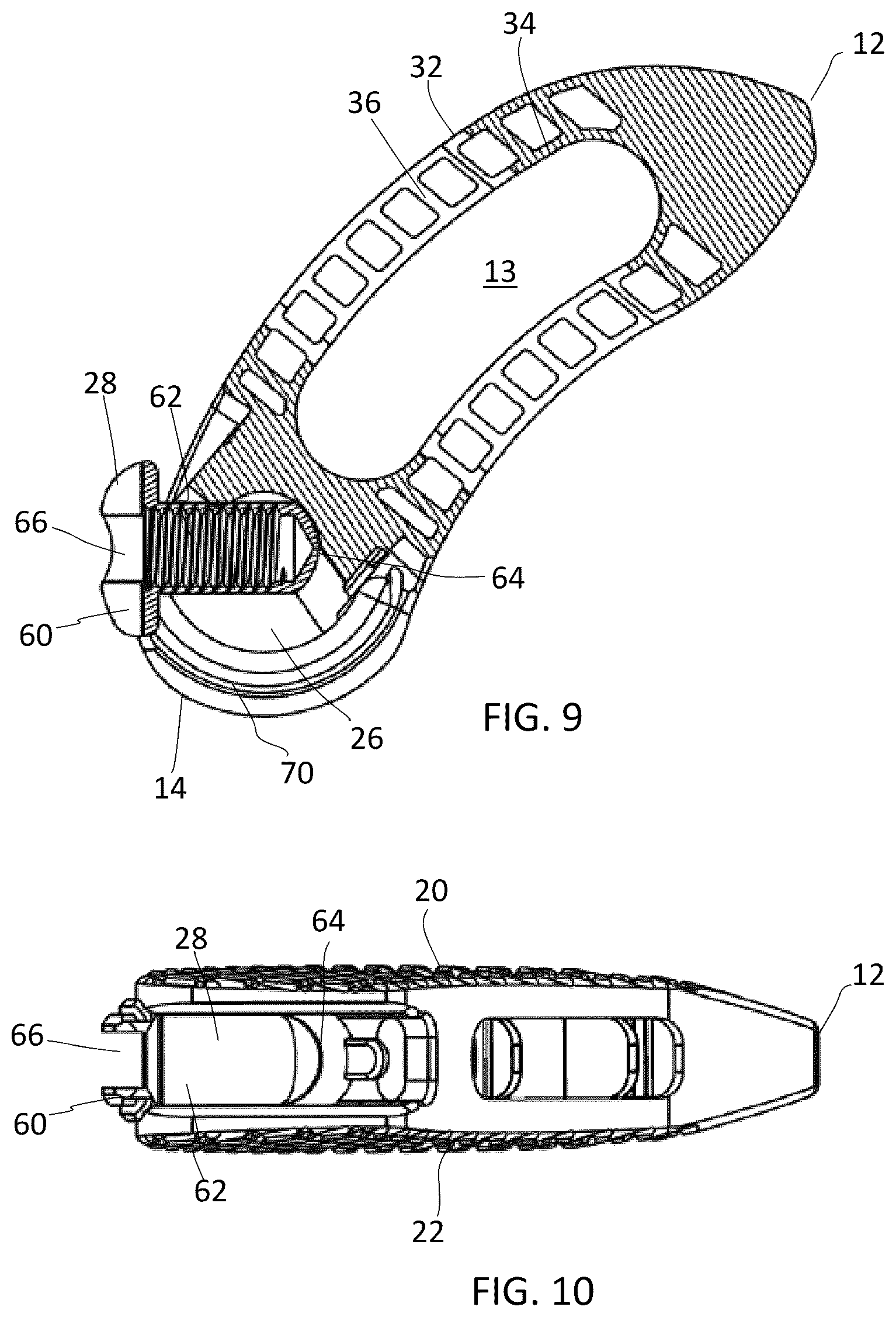 Patent US12090060 Figure 4 – Inter vertebral spinal implant